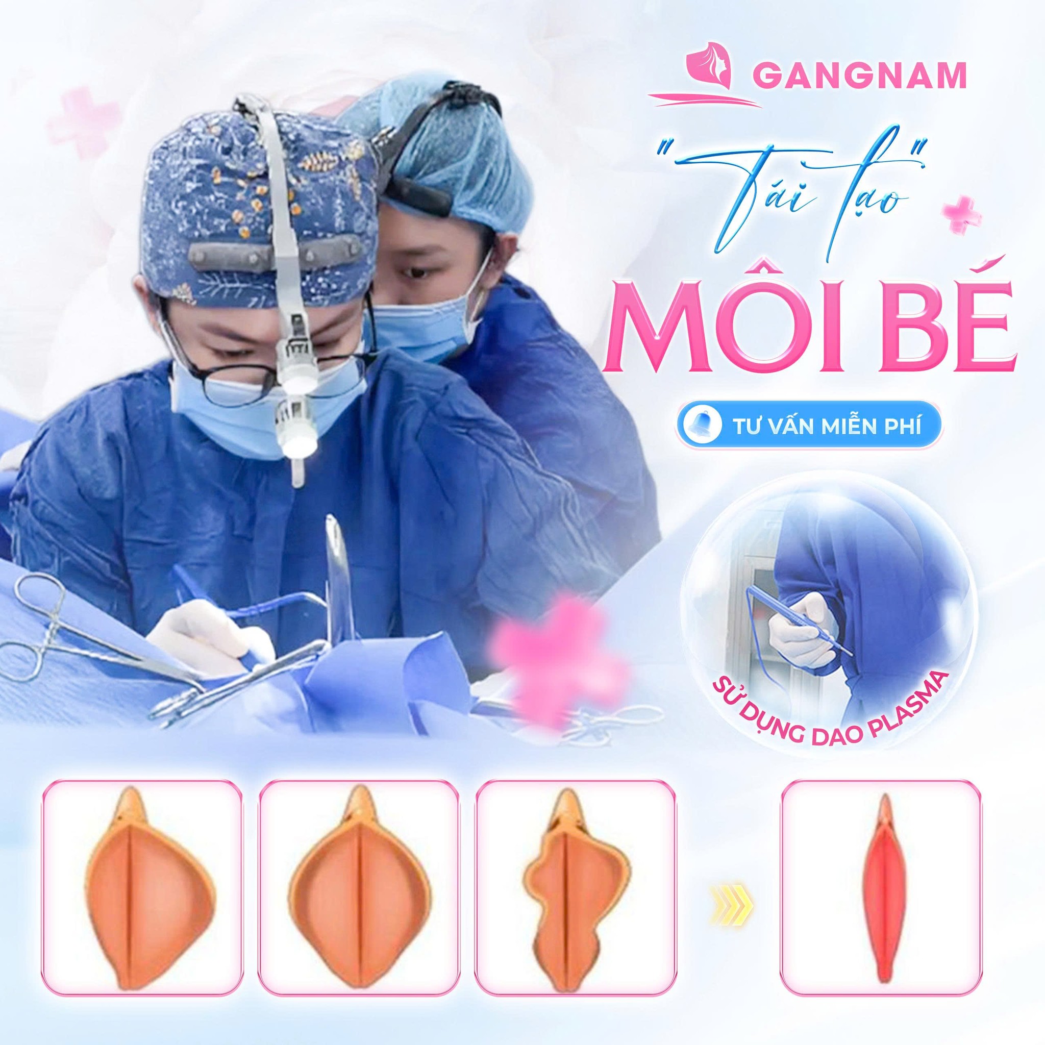 Cắt môi bé thẩm mỹ: Bí quyết giúp vùng kín gọn gàng, tự tin hơn 4 Cắt môi bé thẩm mỹ là gì?