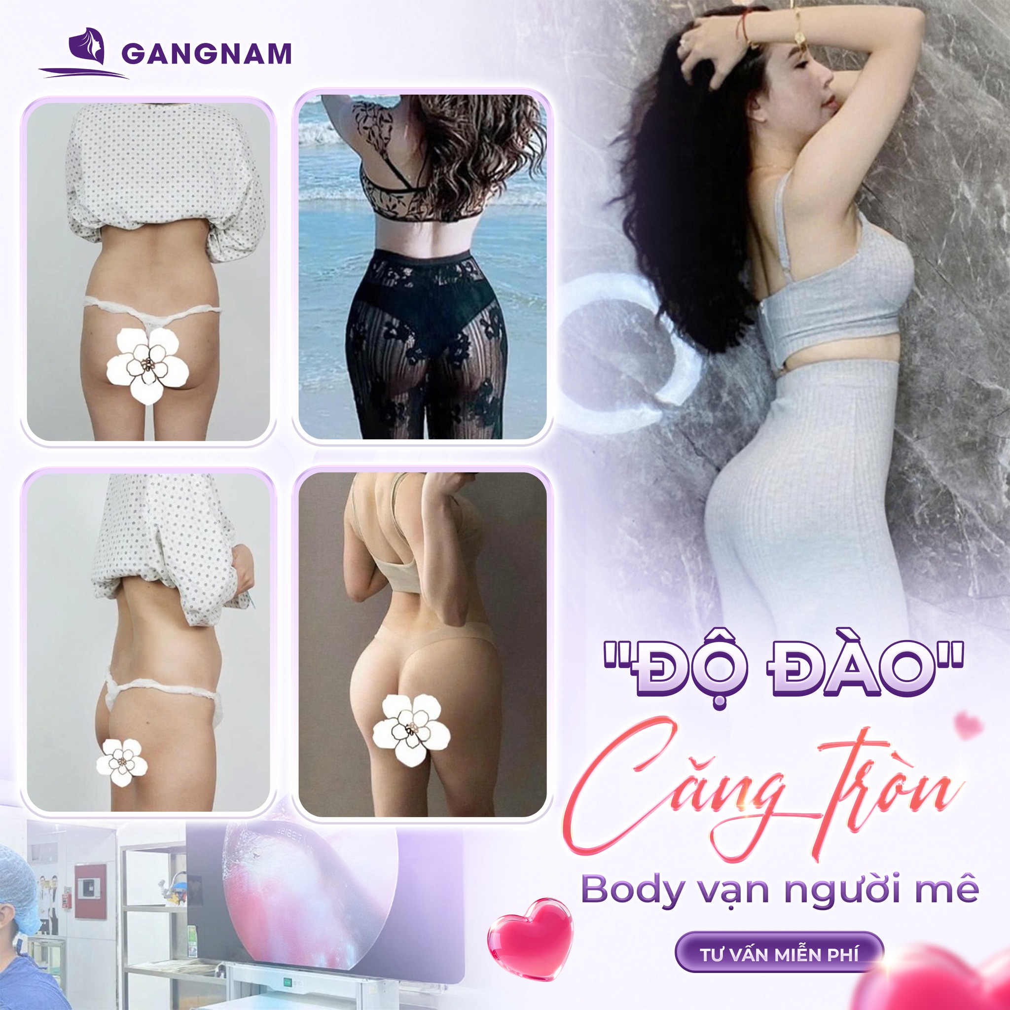 Nâng Mông Nội Soi Túi Độn: Giải Pháp Tạo Vòng 3 Căng Tròn, Bền Đẹp 4 Nâng mông nội soi túi độn là gì