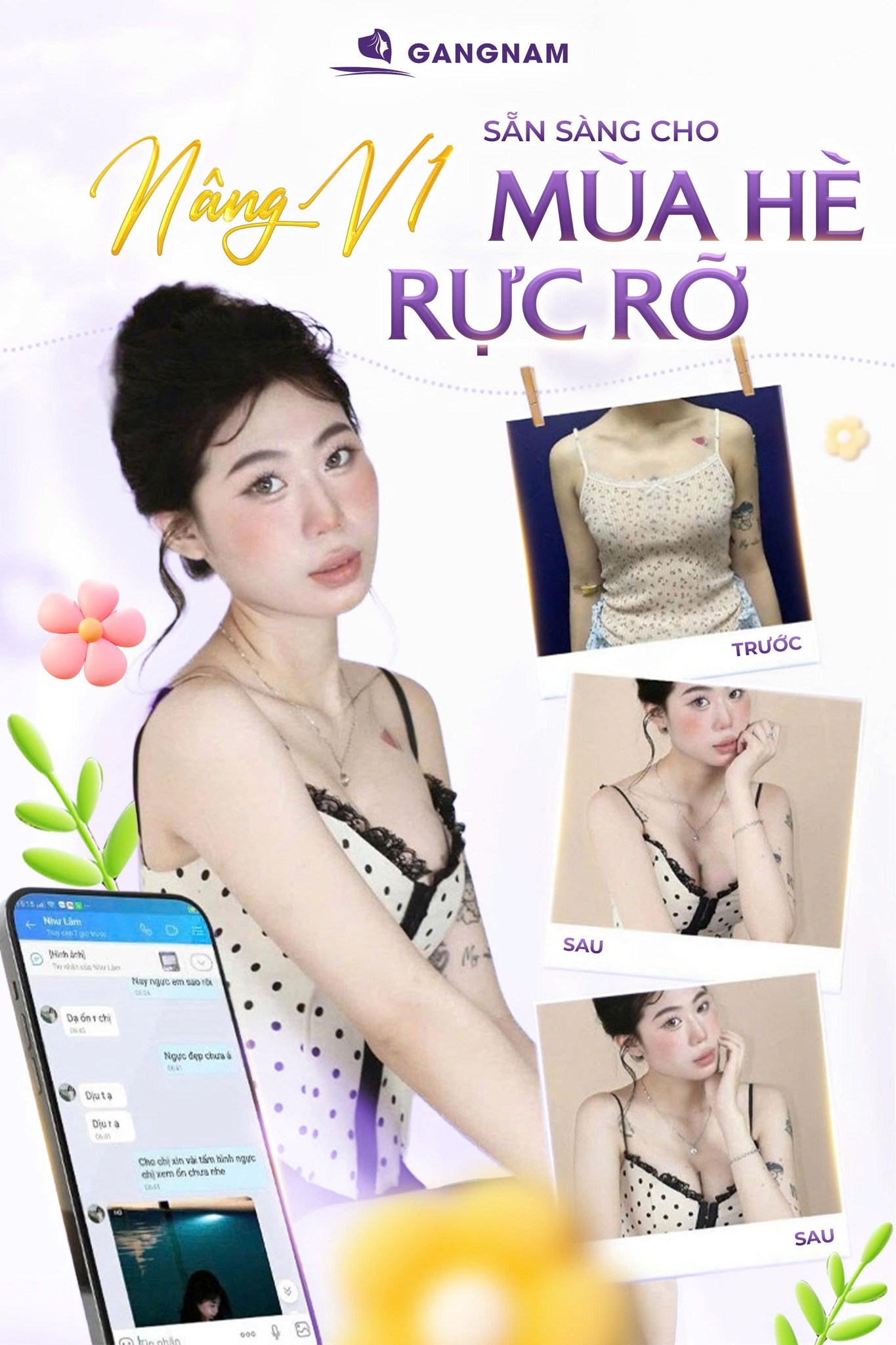 Nâng Ngực Nội Soi Chuẩn Form: Giải Pháp Tạo Dáng Vòng 1 Tự Nhiên 6 Nâng ngực nội soi chuẩn form tại Thẩm mỹ Gangnam