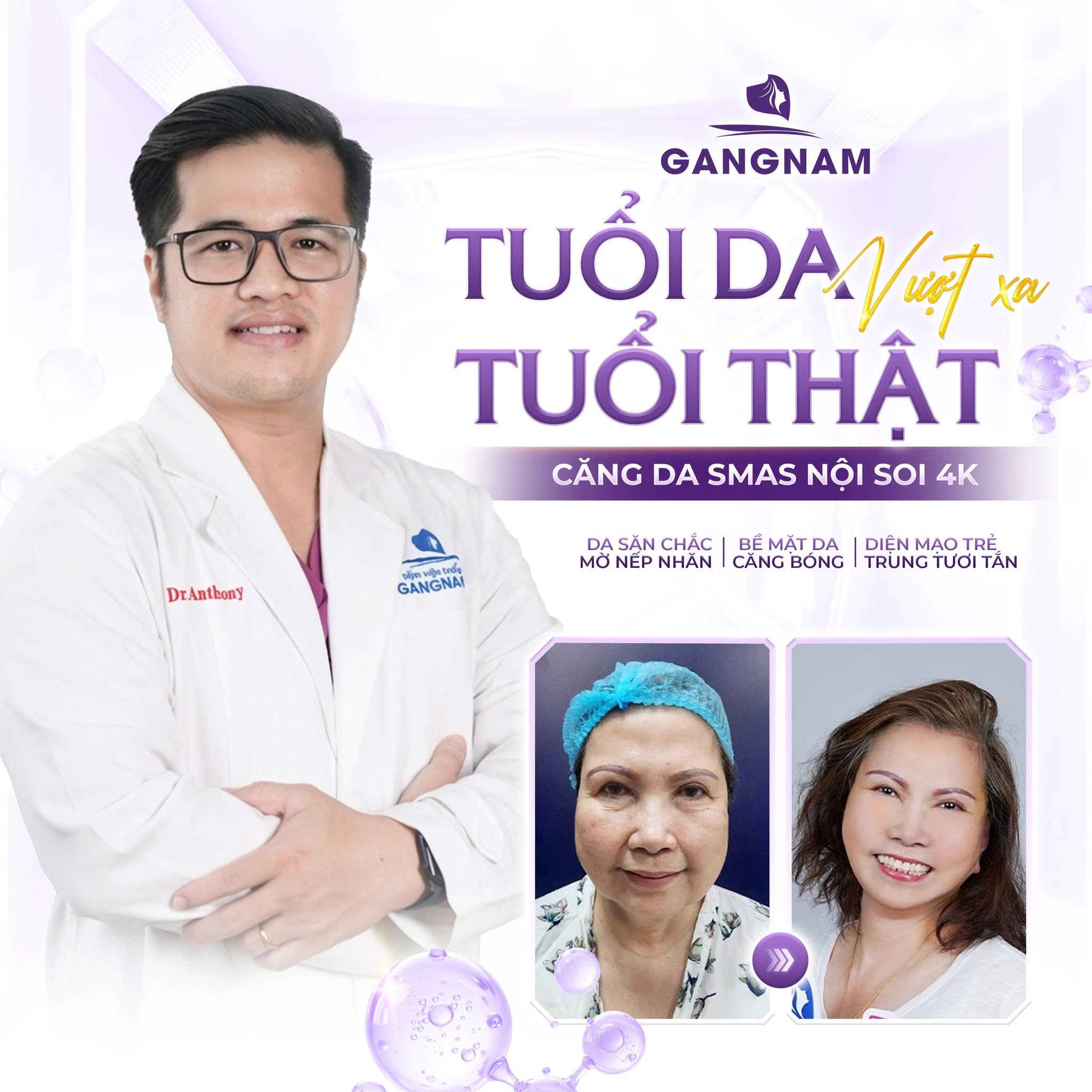 Nâng cơ mặt nội soi: Giải pháp trẻ hóa tự nhiên, ít xâm lấn và duy trì lâu dài 6 Nâng cơ mặt nội soi tại Thẩm mỹ Gangnam