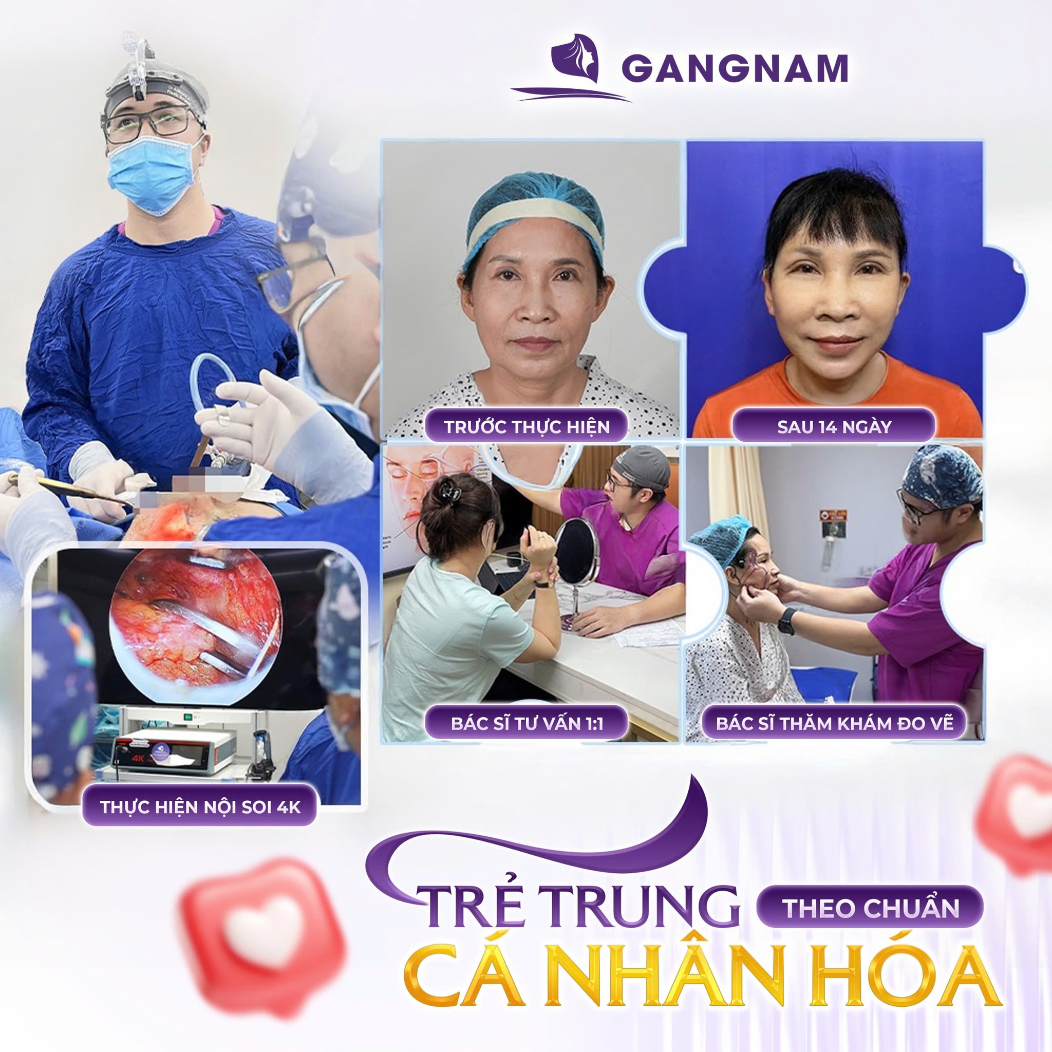 Trẻ Hóa Da Mặt Nội Soi Là Gì? Ưu Điểm, Quy Trình Và Hiệu Quả Thực Tế 6 Thẩm mỹ Gangnam – Kiến tạo vẻ đẹp tự nhiên và hài hòa