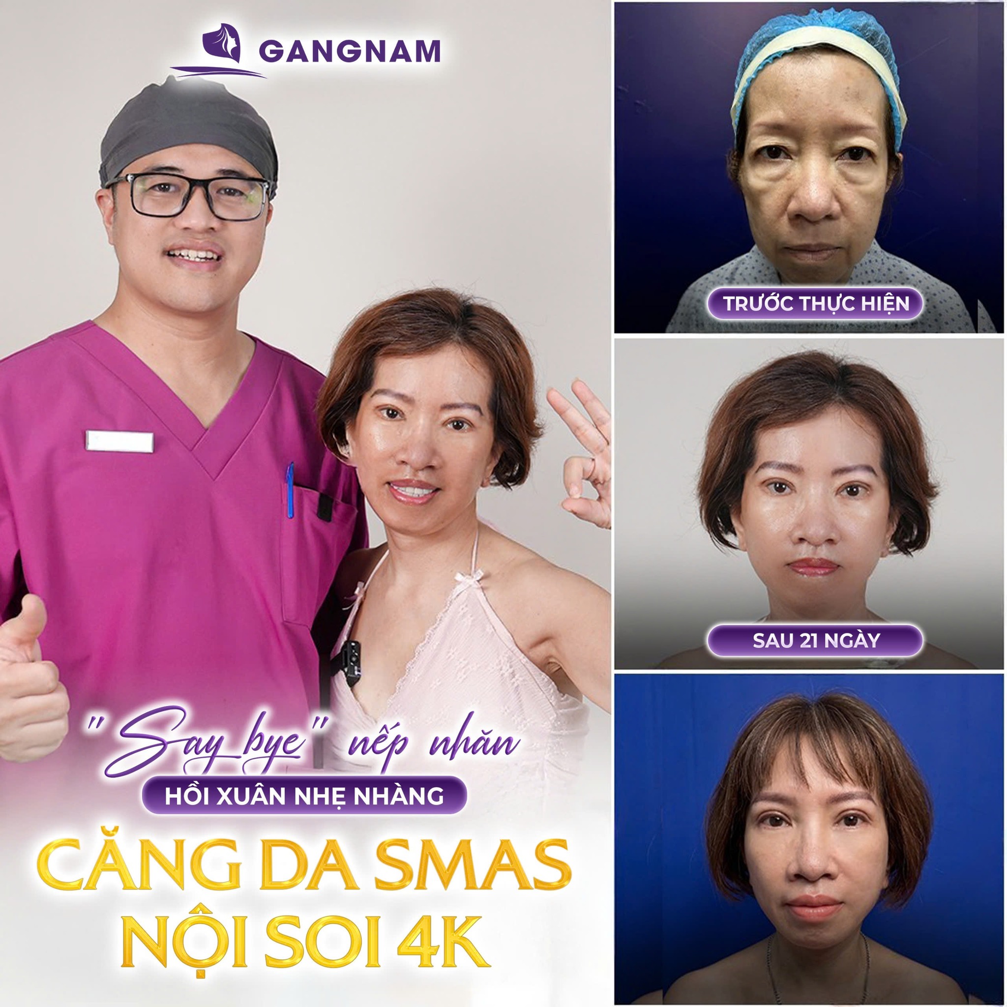 Căng da mặt 4k công nghệ cao: Giải pháp trẻ hóa tầng sâu giúp lưu giữ nét thanh xuân 5 Quy trình thực hiện căng da mặt 4k công nghệ cao chuẩn y khoa