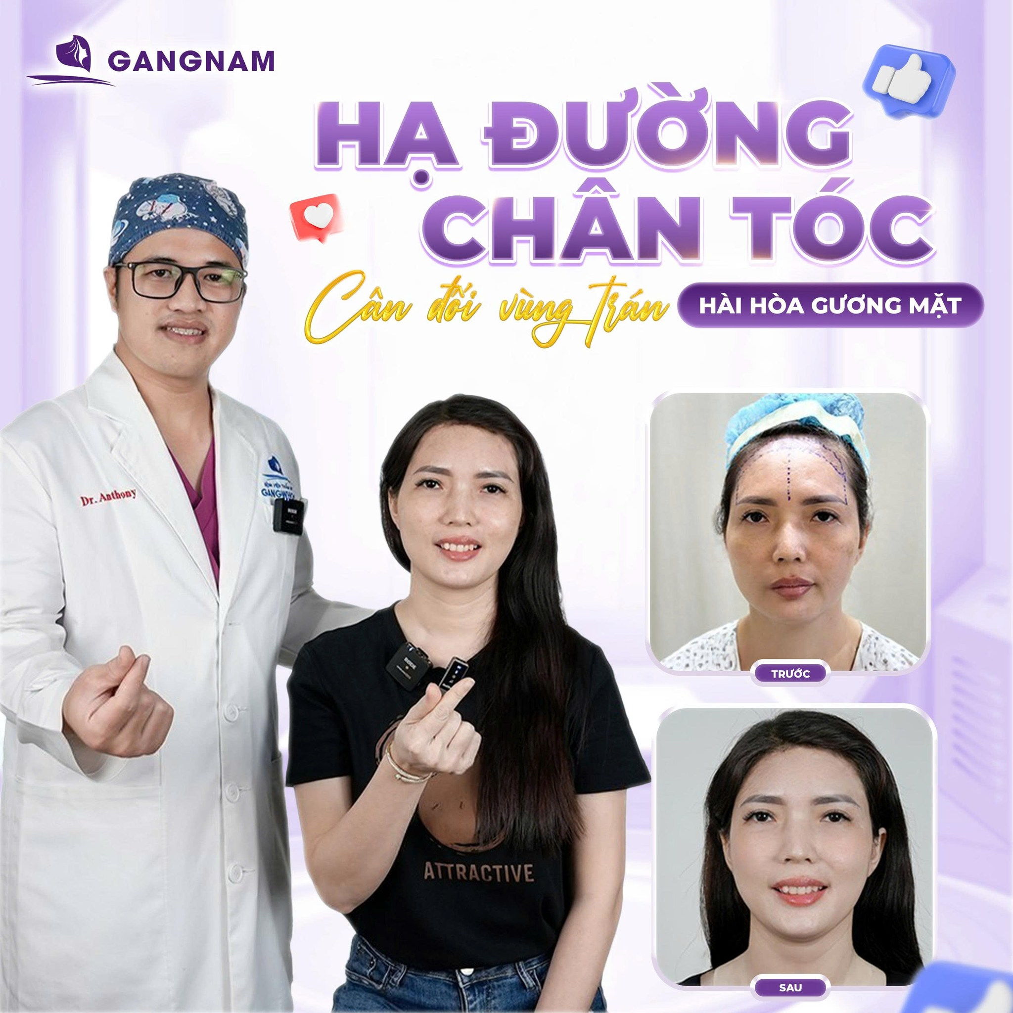 Hạ Đường Chân Tóc Nội Soi: Giải Pháp Thu Gọn Trán Cao An Toàn, Tự Nhiên 6 Thẩm mỹ Gangnam – Chuẩn y khoa, nâng tầm nhan sắc