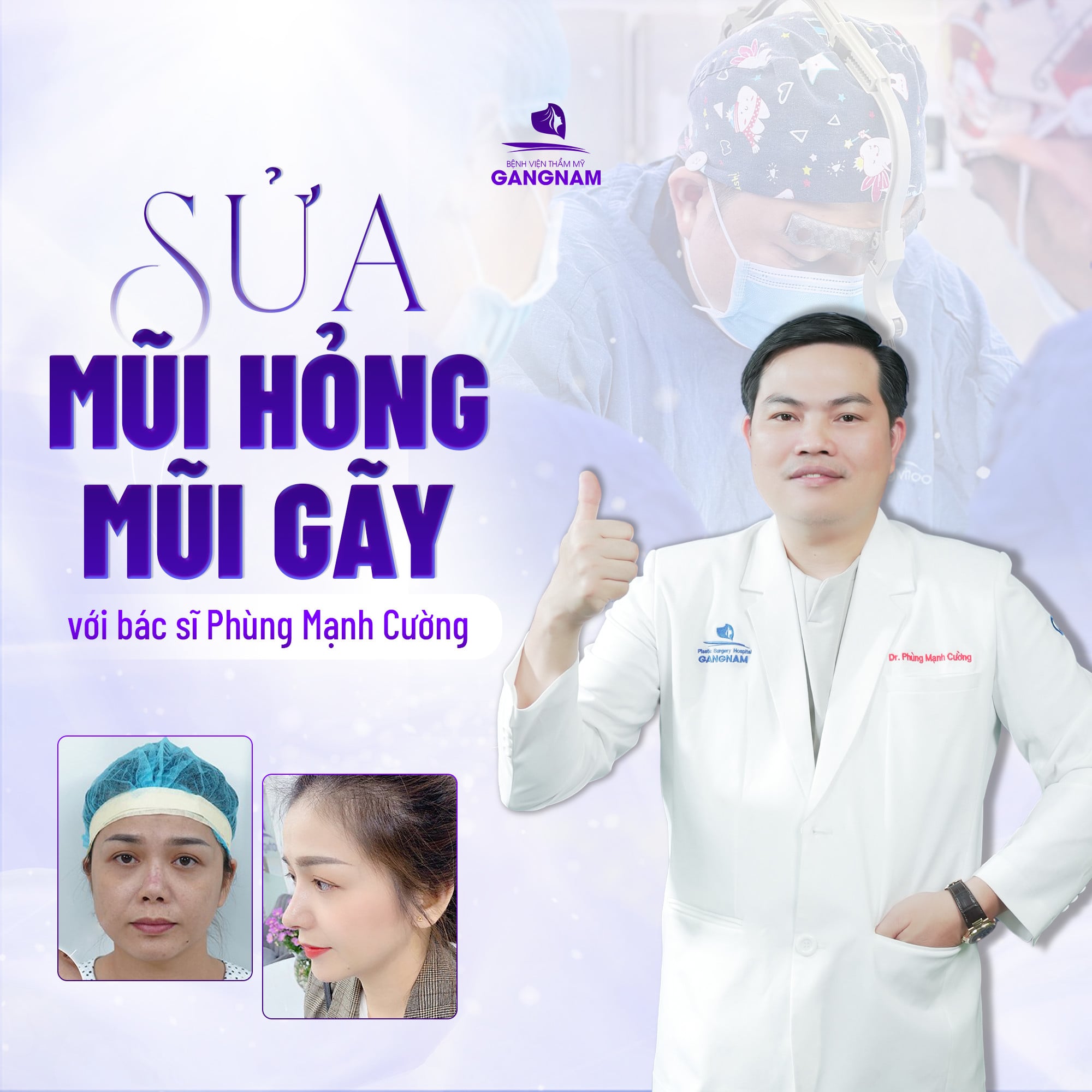 Tái cấu trúc mũi hỏng chuẩn y khoa: Lấy lại dáng mũi đẹp và chức năng hô hấp 6 Tái cấu trúc mũi hỏng chuẩn y khoa tại Thẩm mỹ Gangnam