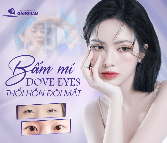 Cắt Mí Dove Eyes Hiện Đại: Giải Pháp Tạo Đôi Mắt To Tròn Tự Nhiên 4 Cắt mí dove eyes hiện đại là gì