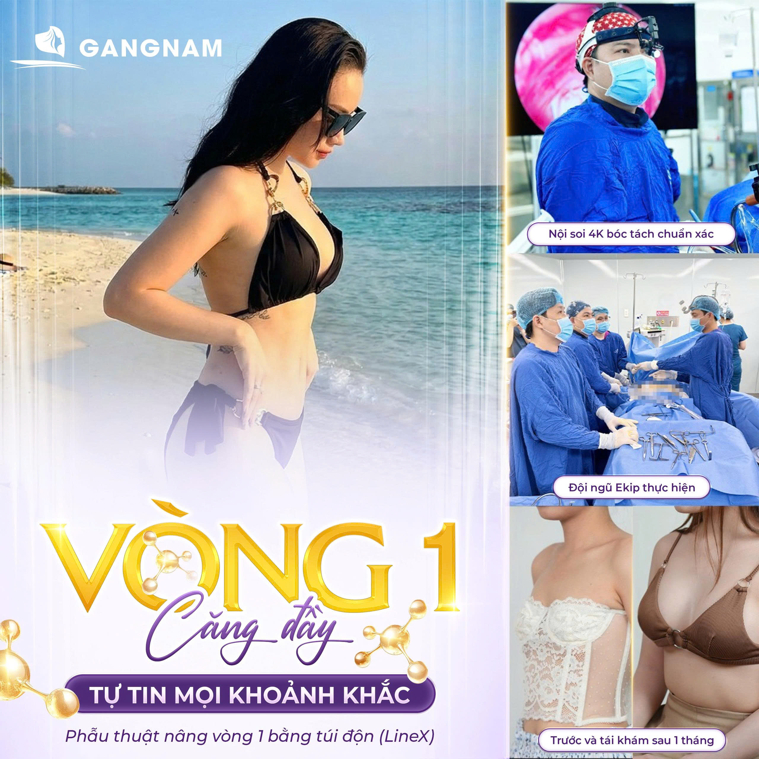 Nâng Ngực Công Nghệ Nội Soi: Giải Pháp An Toàn Cho Vòng Một Tự Nhiên 6 Nâng ngực công nghệ nội soi tại Thẩm mỹ Gangnam