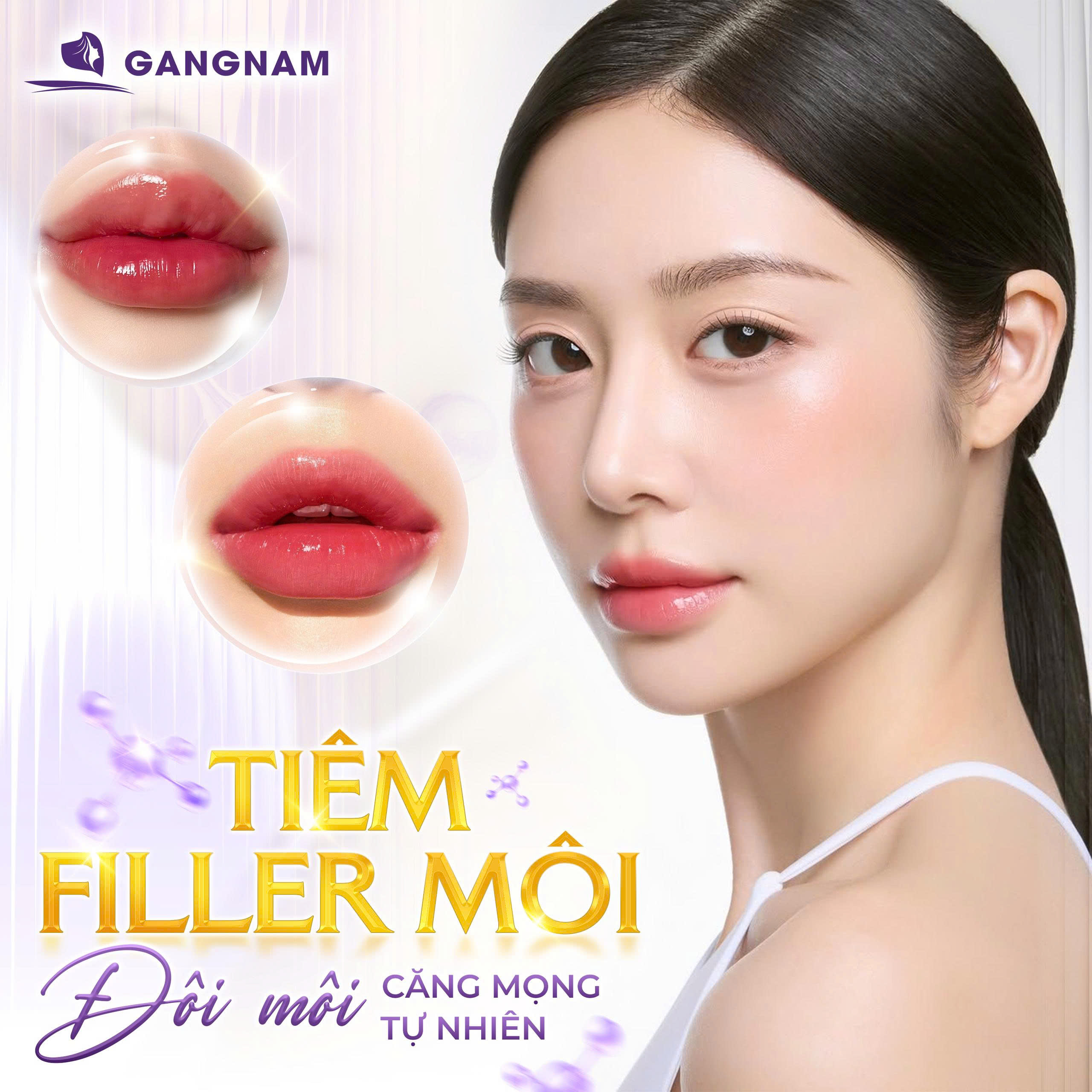 Tiêm Filler Môi Căng Mọng Tự Nhiên: Giải Pháp Tạo Hình Đôi Môi Quyến Rũ 4 Tiêm Filler môi căng mọng tự nhiên là gì