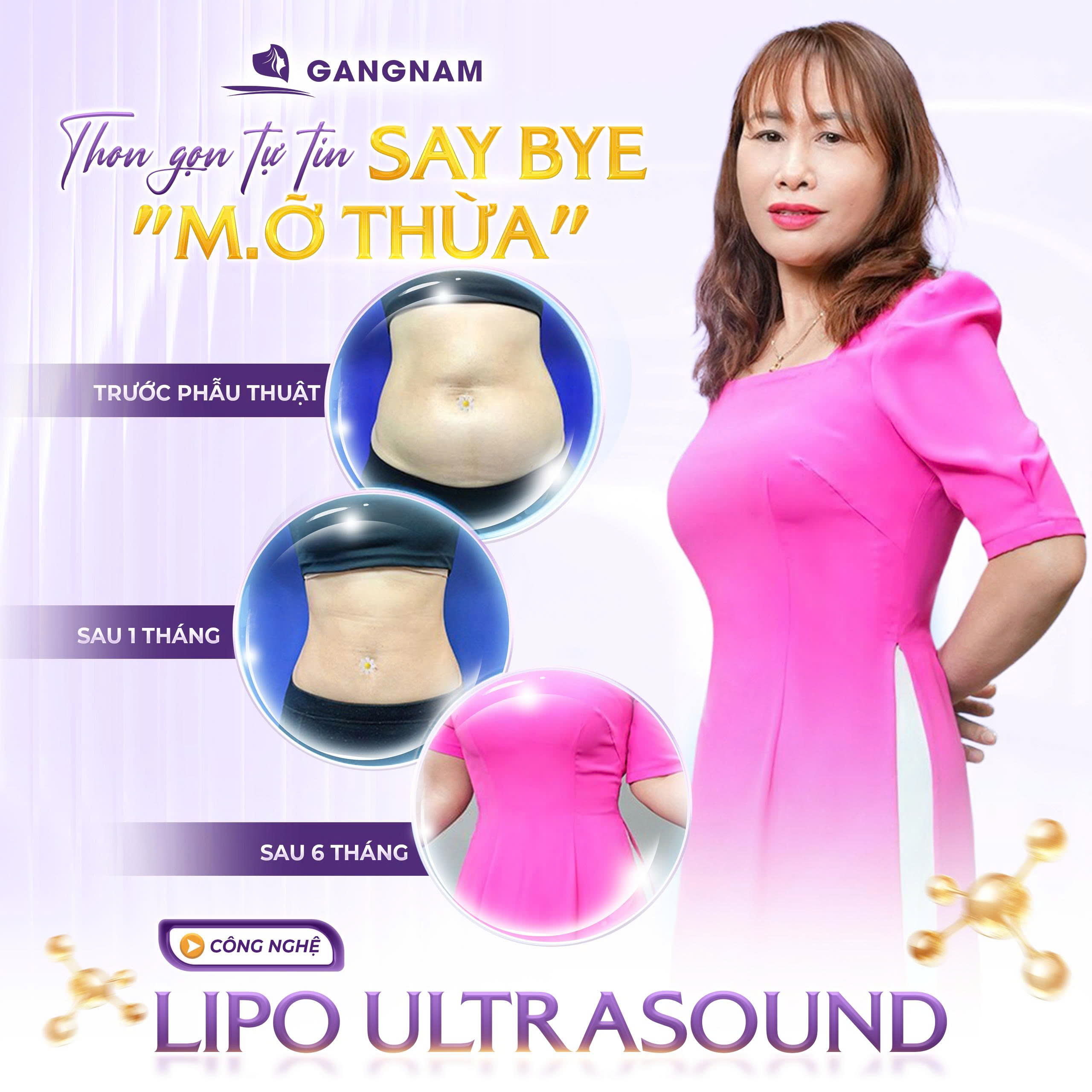 Hút Mỡ Hông Công Nghệ Lipo Ultrasound –Tạo Đường Cong Eo Hông Săn Chắc 6 HÚT MỠ HÔNG CÔNG NGHỆ LIPO – TẠO ĐƯỜNG CONG CÂN ĐỐI, QUYẾN RŨ