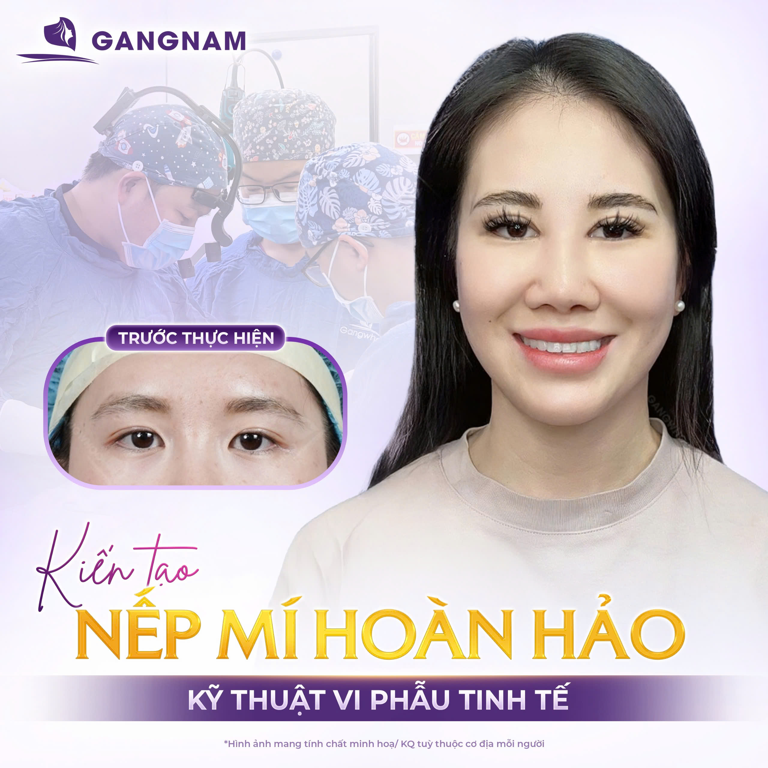 Cắt Mí Eyelid Hiện Đại: Bí Quyết Sở Hữu Đôi Mắt Trẻ Trung, Hài Hòa Tự Nhiên 6 Thẩm mỹ Gangnam – Lựa chọn hàng đầu cho cắt mí Eyelid hiện đại