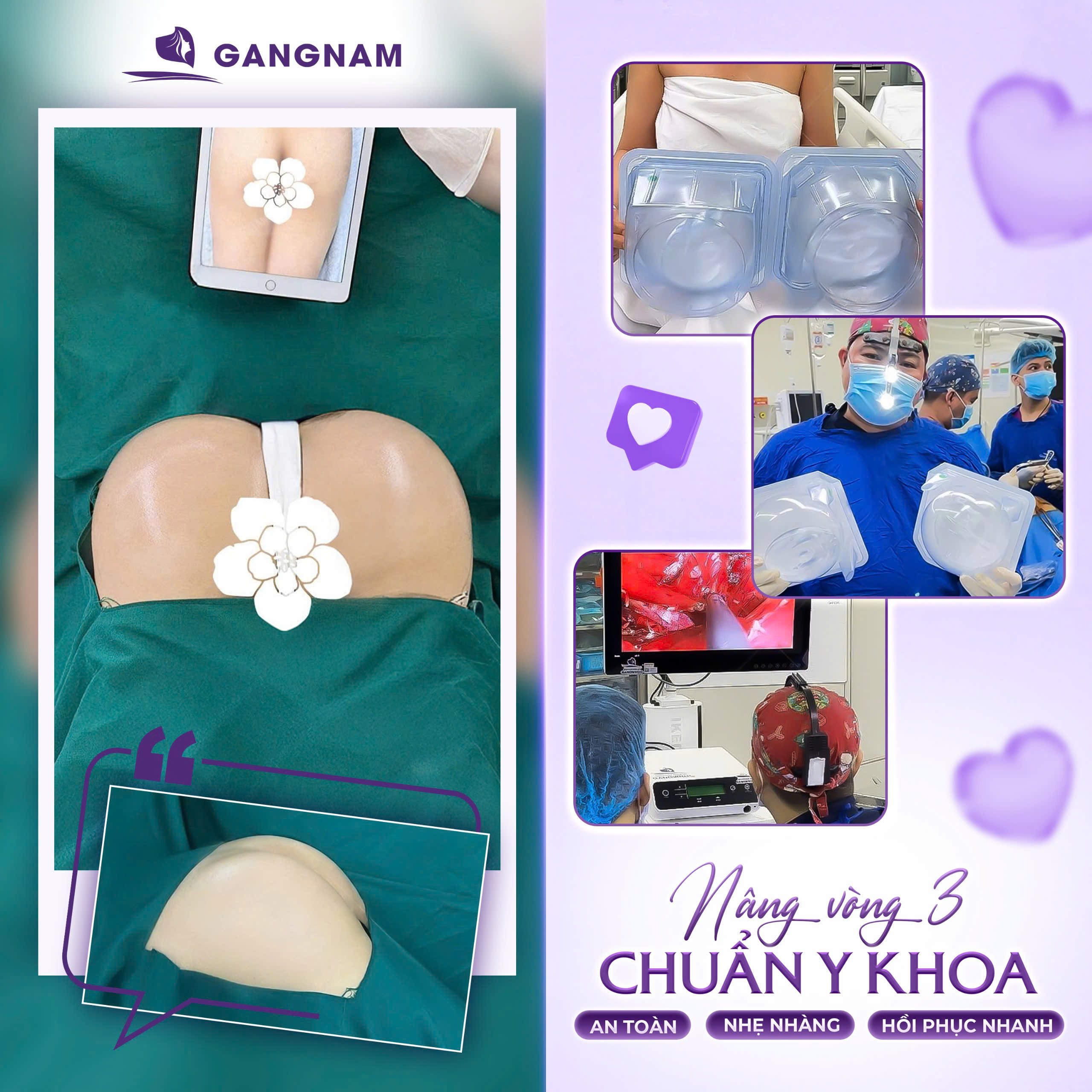 Nâng mông 3D đẹp tự nhiên – Giải pháp tạo dáng vòng 3 cân đối và mềm mại 6 Nâng mông 3D đẹp tự nhiên tại Thẩm mỹ Gangnam