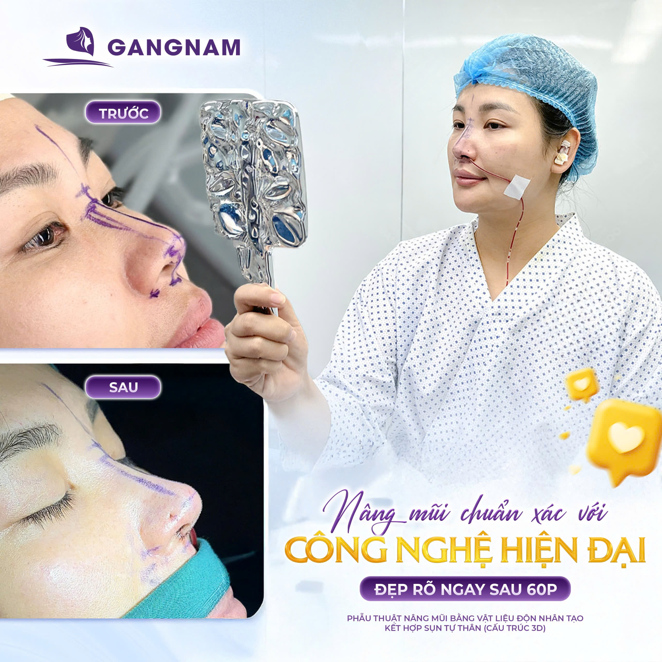 Nâng Mũi Chuẩn Y Khoa: Giải Pháp Tạo Dáng Mũi An Toàn, Tự Nhiên 5 Nâng mũi cấu trúc trong nâng mũi chuẩn y khoa