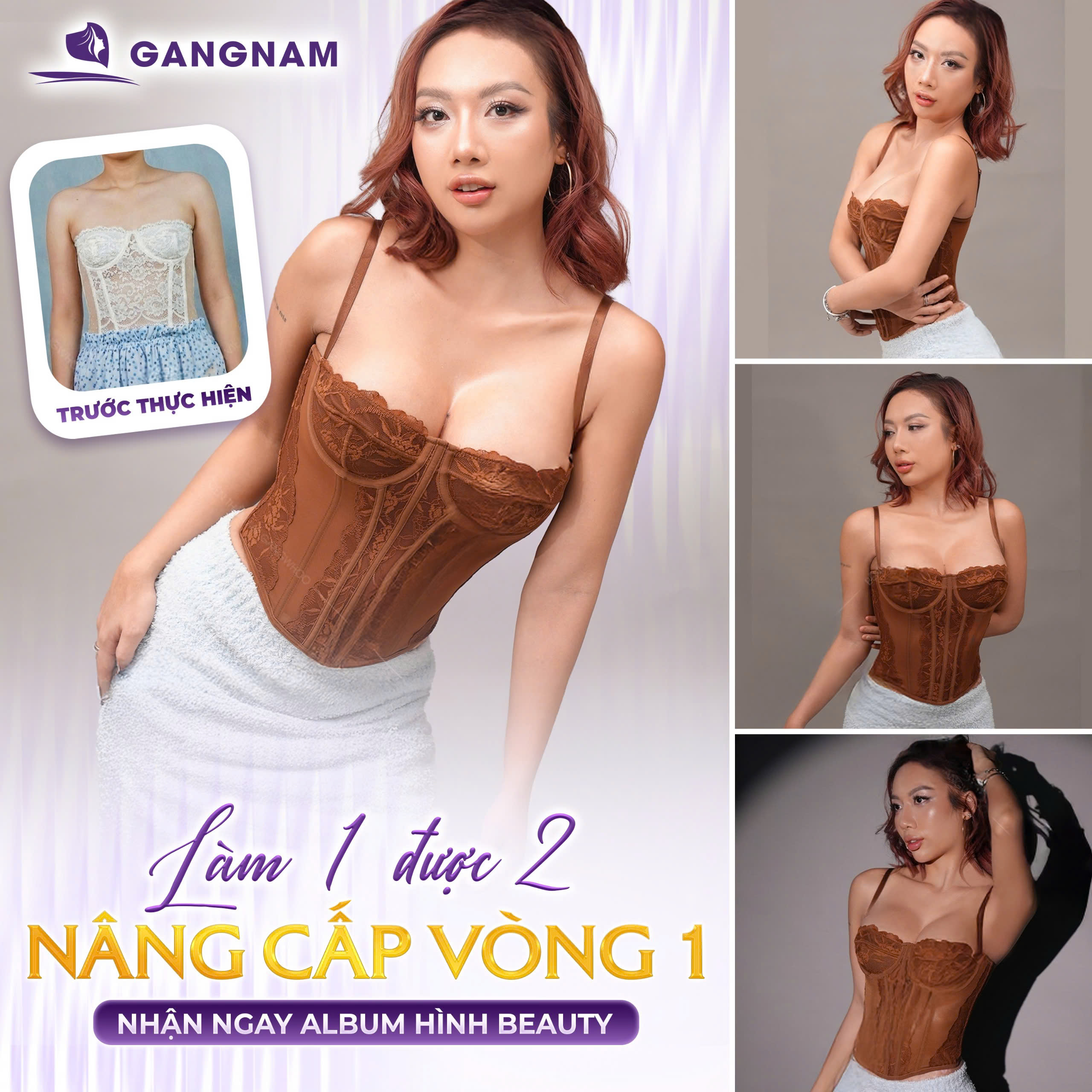 Nâng ngực nội soi 4K túi độn: Công nghệ hiện đại cho vòng 1 mềm mại 4 Nâng ngực nội soi 4K túi độn là gì?