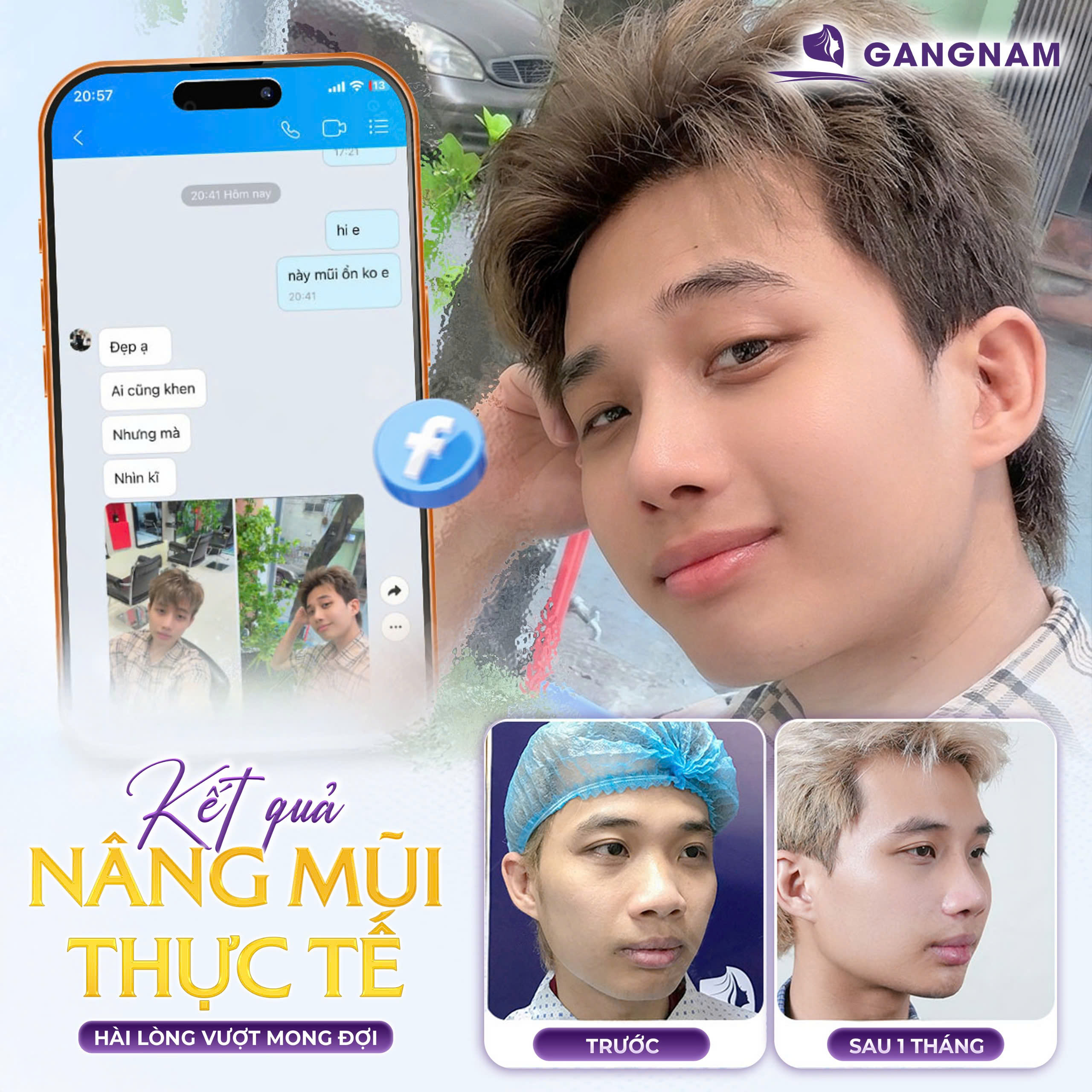 Nâng Mũi Chuẩn Y Khoa: Giải Pháp Tạo Dáng Mũi An Toàn, Tự Nhiên 6 Thẩm mỹ Gangnam – Địa chỉ làm đẹp uy tín, chuẩn y khoa