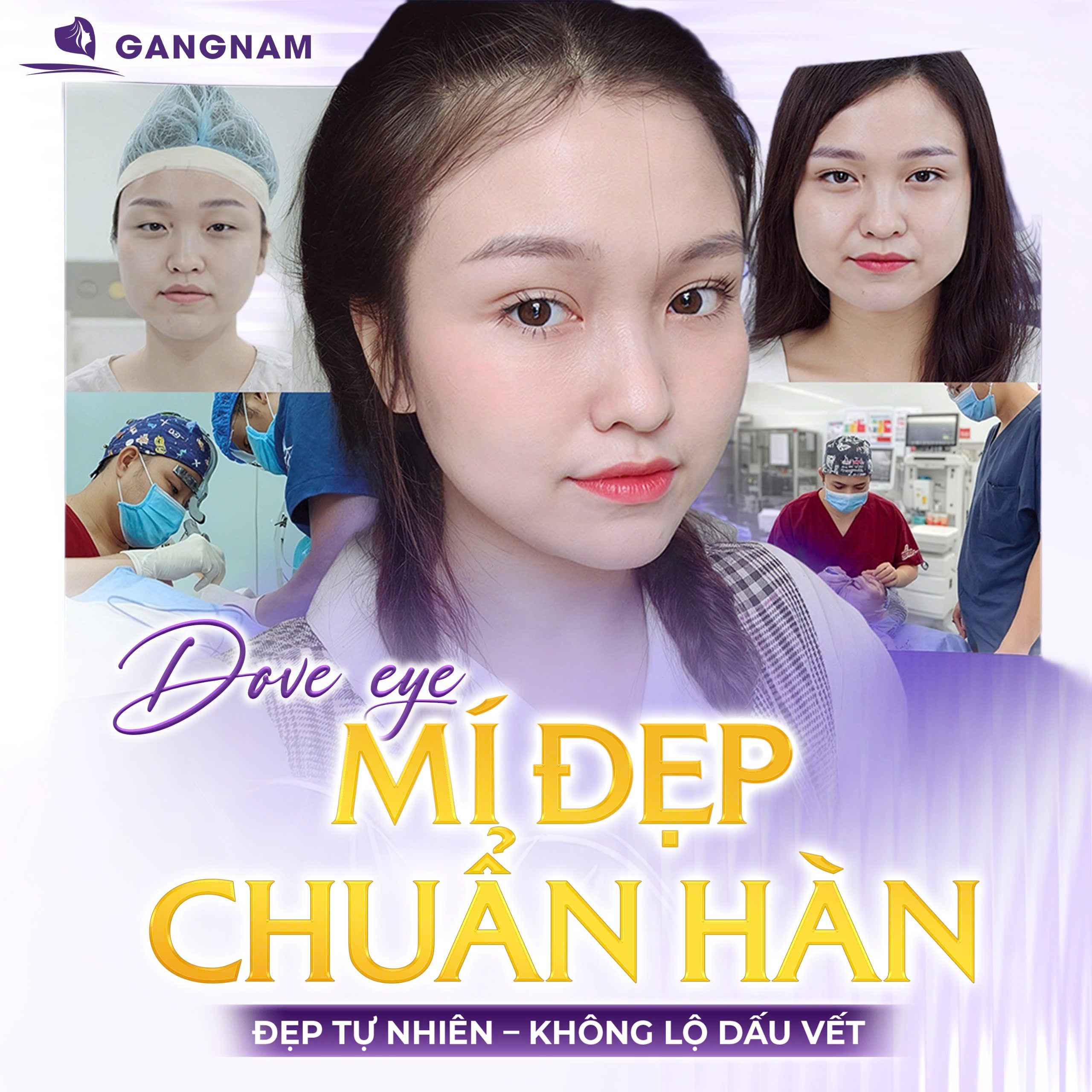 Cắt Mí Chuẩn Y Khoa: Giải Pháp Tạo Mắt Hai Mí Tự Nhiên, An Toàn Và Lâu Dài 4 Cắt mí chuẩn y khoa là gì