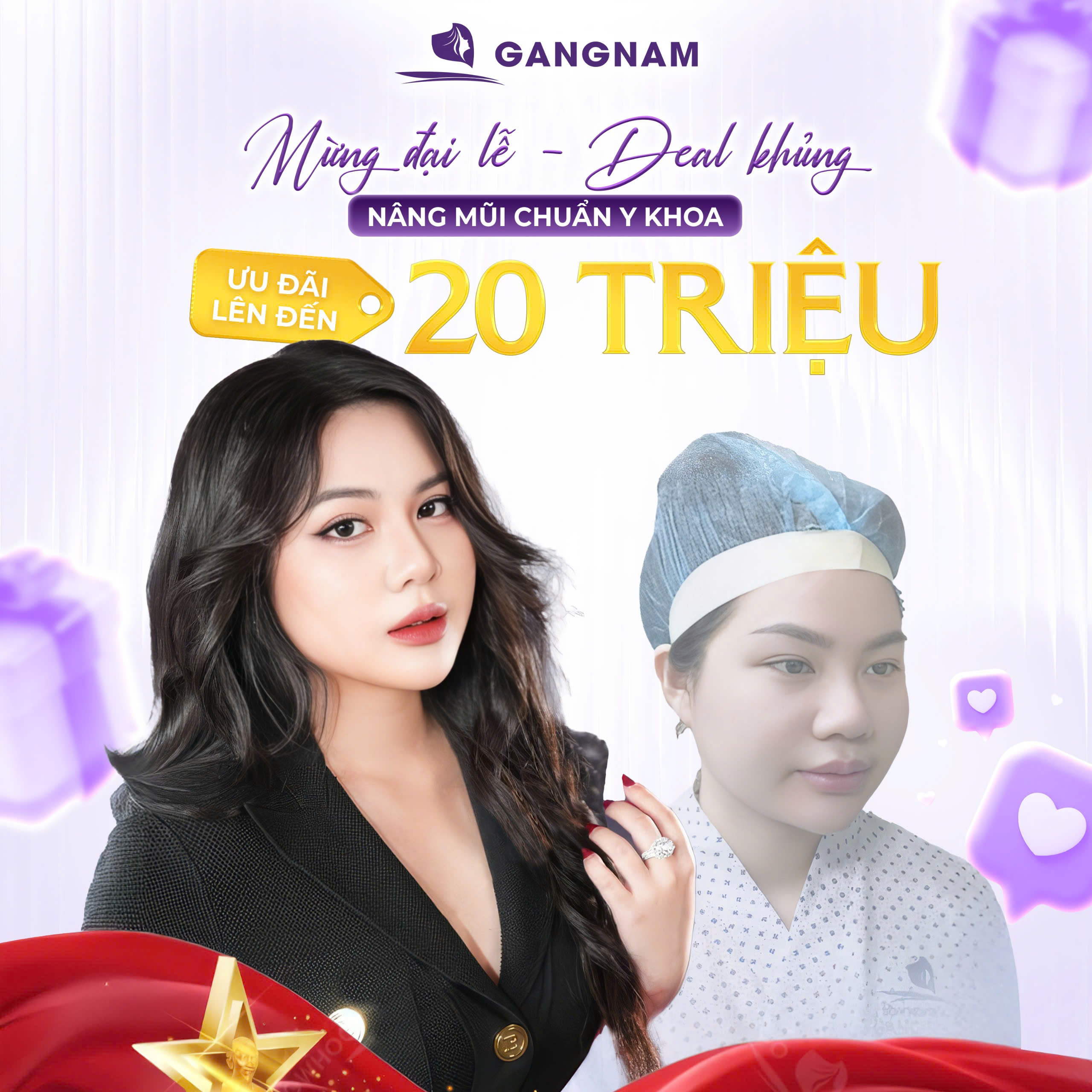 Nâng mũi cấu trúc bọc sụn: Giải pháp toàn diện cho dáng mũi đẹp tự nhiên 6 Nâng mũi cấu trúc bọc sụn tại Thẩm mỹ Gangnam