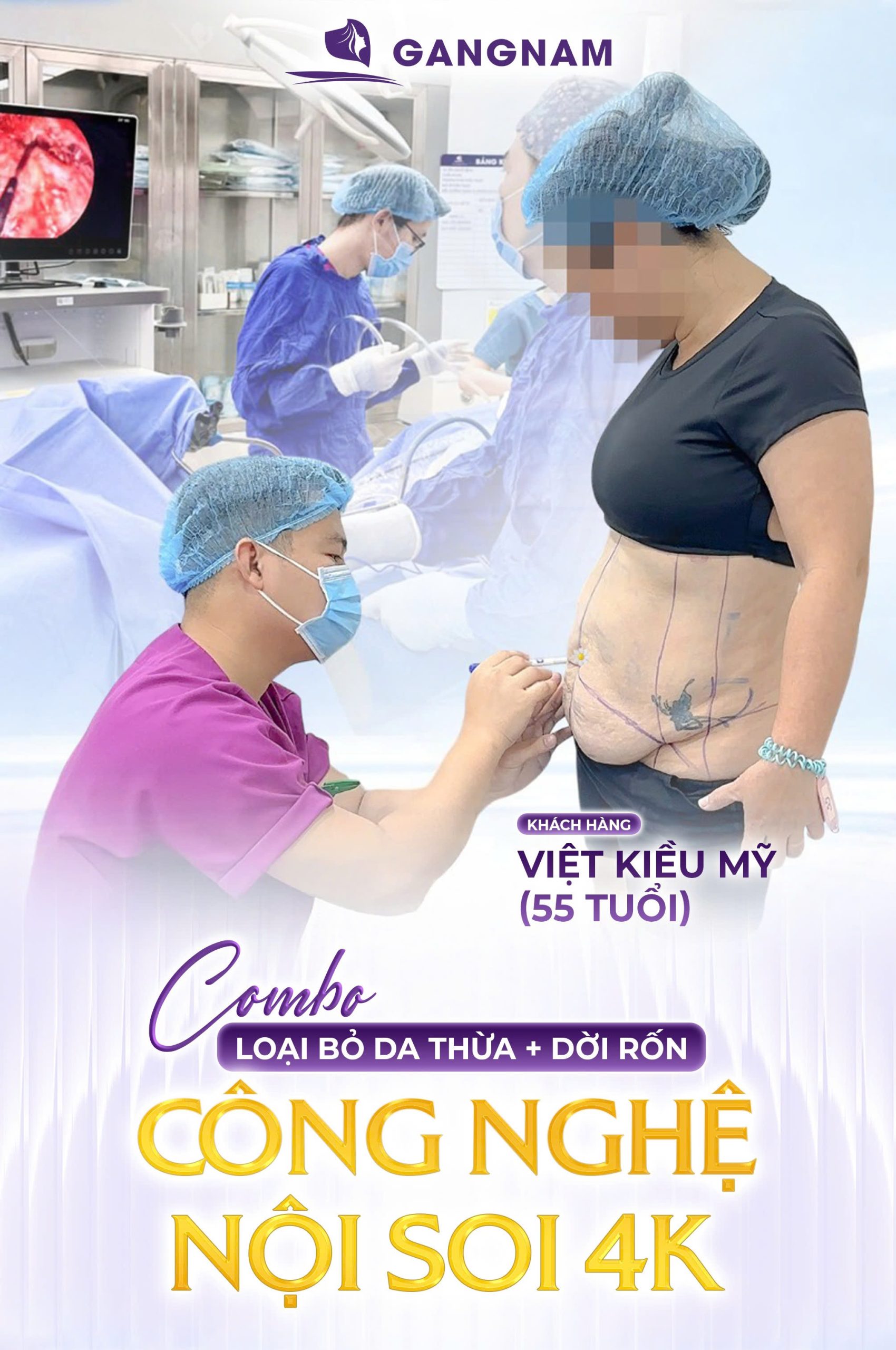 Hút mỡ bụng Lipo nội soi: Giải pháp đột phá cho vòng eo thon gọn và săn chắc 5 Quy trình chuẩn y khoa khi thực hiện hút mỡ bụng Lipo nội soi