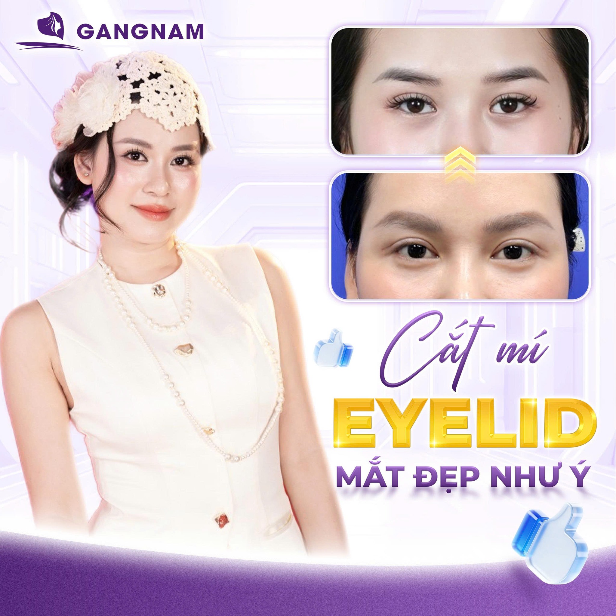 Cắt mí mắt Eyelid – Giải pháp tạo đôi mắt hai mí tự nhiên 6 Cắt mí mắt Eyelid tại Thẩm mỹ Gangnam – Tự nhiên và hài hòa