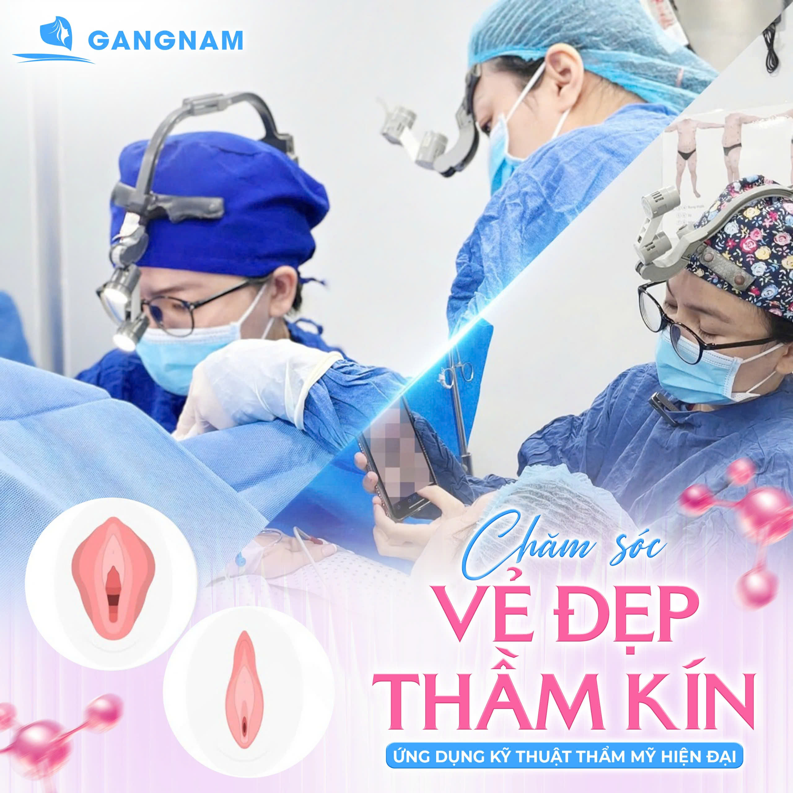 Phẫu thuật tạo hình vùng kín: Giải pháp toàn diện để giữ lửa hạnh phúc 6 Phẫu thuật tạo hình vùng kín an toàn, tinh tế tại Thẩm mỹ Gangnam