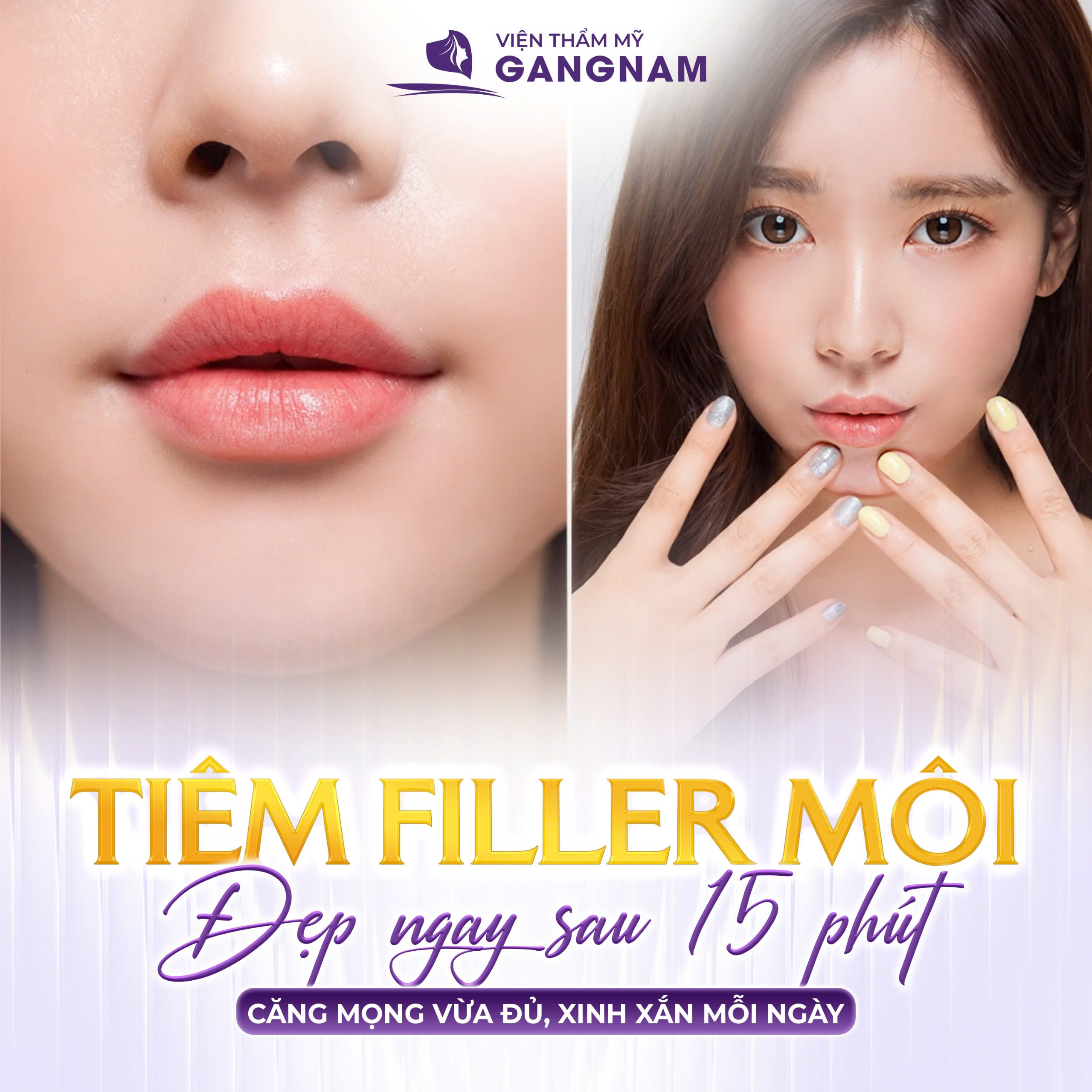 Tiêm Filler Môi Trái Tim Hàn Quốc: Xu Hướng Làm Đẹp Chuẩn Tỉ Lệ Vàng 6 Tiêm filler môi tại Thẩm mỹ Gangnam – Nhanh chóng, an toàn, tự nhiên