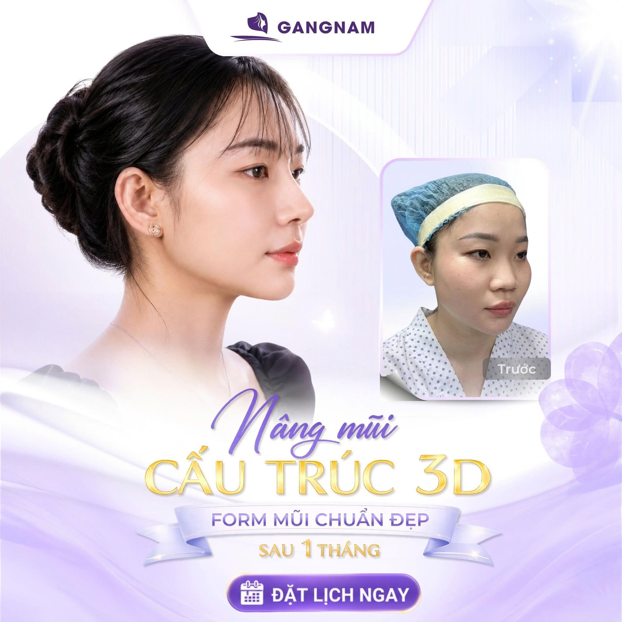Nâng Mũi Cấu Trúc 3D Tự Nhiên: Giải Pháp Đỉnh Cao Cho Dáng Mũi Hoàn Hảo 4 Công nghệ hiện đại trong nâng mũi cấu trúc 3D tự nhiên