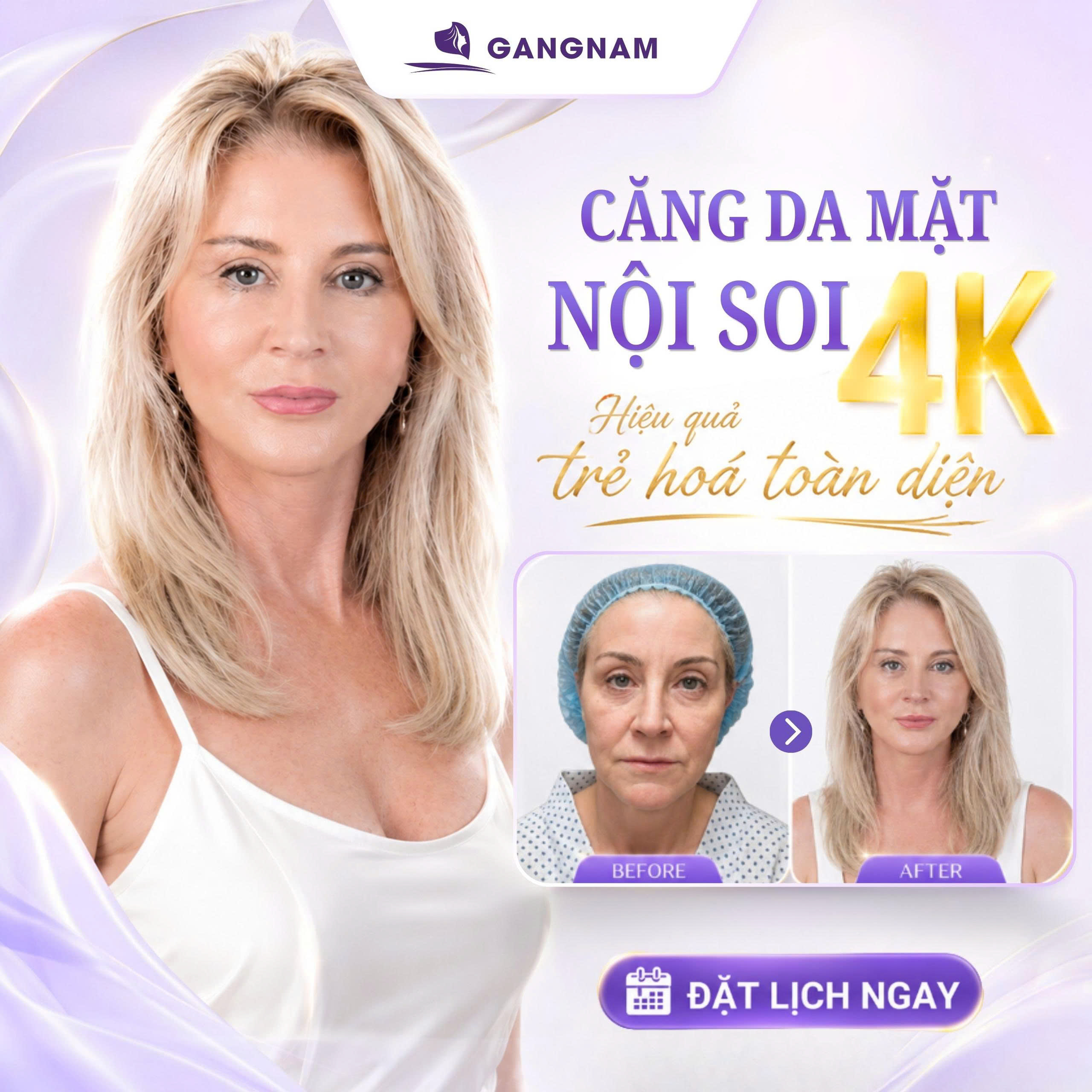 Nội soi 4K căng da mặt – Công nghệ trẻ hóa hiện đại nhất hiện nay 6 Nội soi 4K căng da mặt tại Thẩm mỹ Gangnam