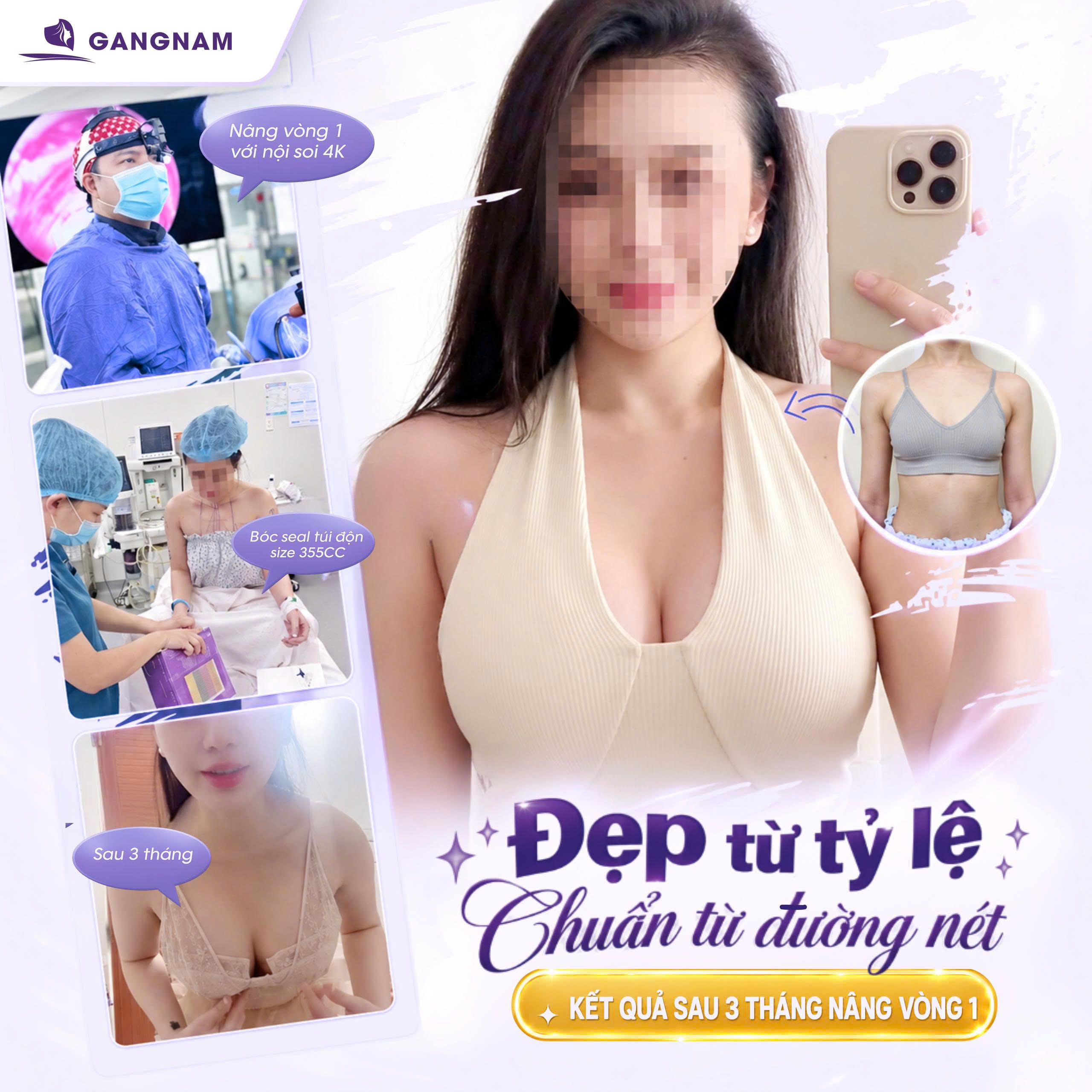 Nâng vòng 1 nội soi công nghệ 4k: Giải pháp an toàn và chính xác cho vòng ngực hoàn hảo 4 Công nghệ nội soi 4k trong nâng vòng 1 nội soi công nghệ 4k hoạt động như thế nào?