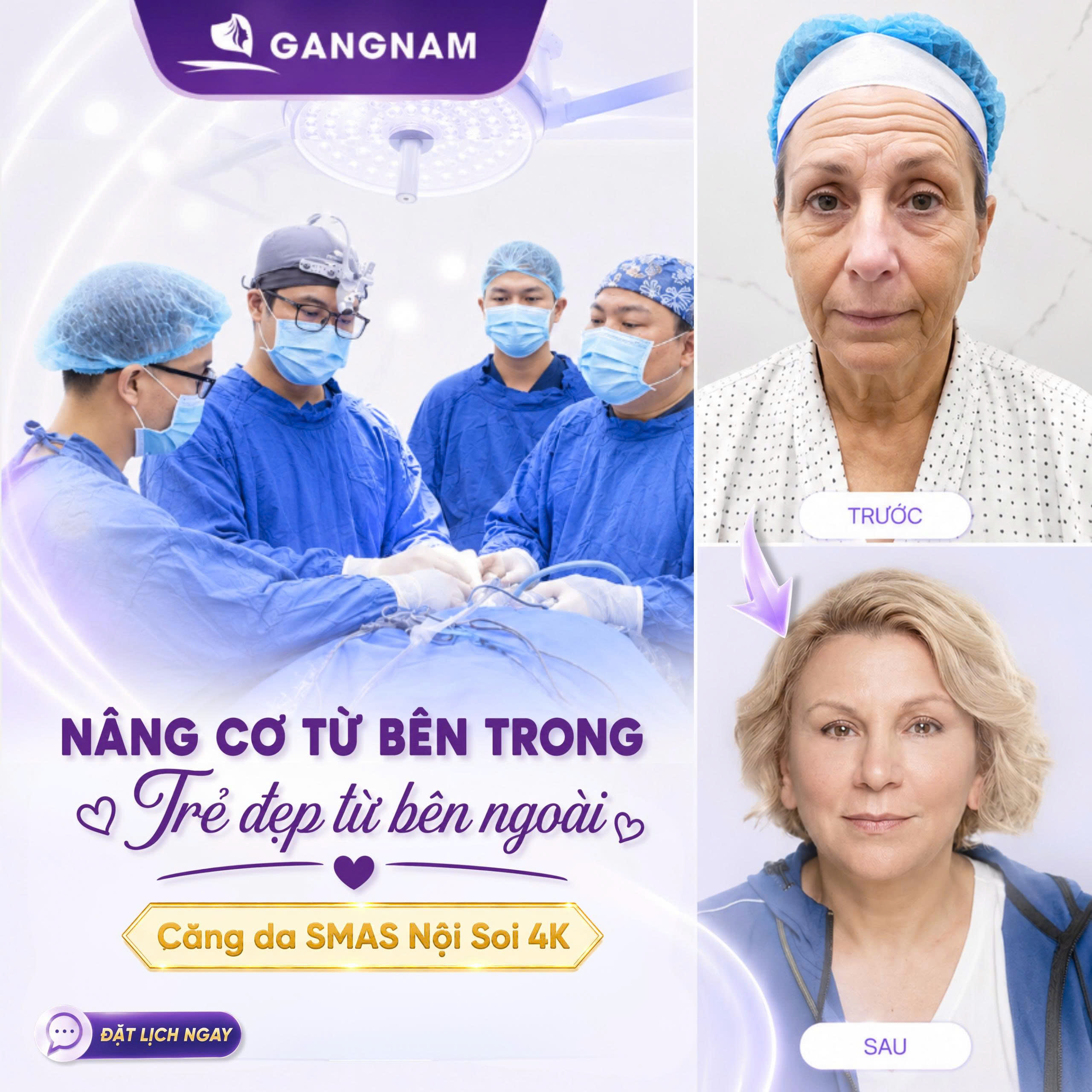 Căng da mặt SMAS nội soi 4K – Công nghệ trẻ hóa da tầng sâu hiện đại 6 Căng da mặt SMAS nội soi 4K tại Thẩm mỹ Gangnam