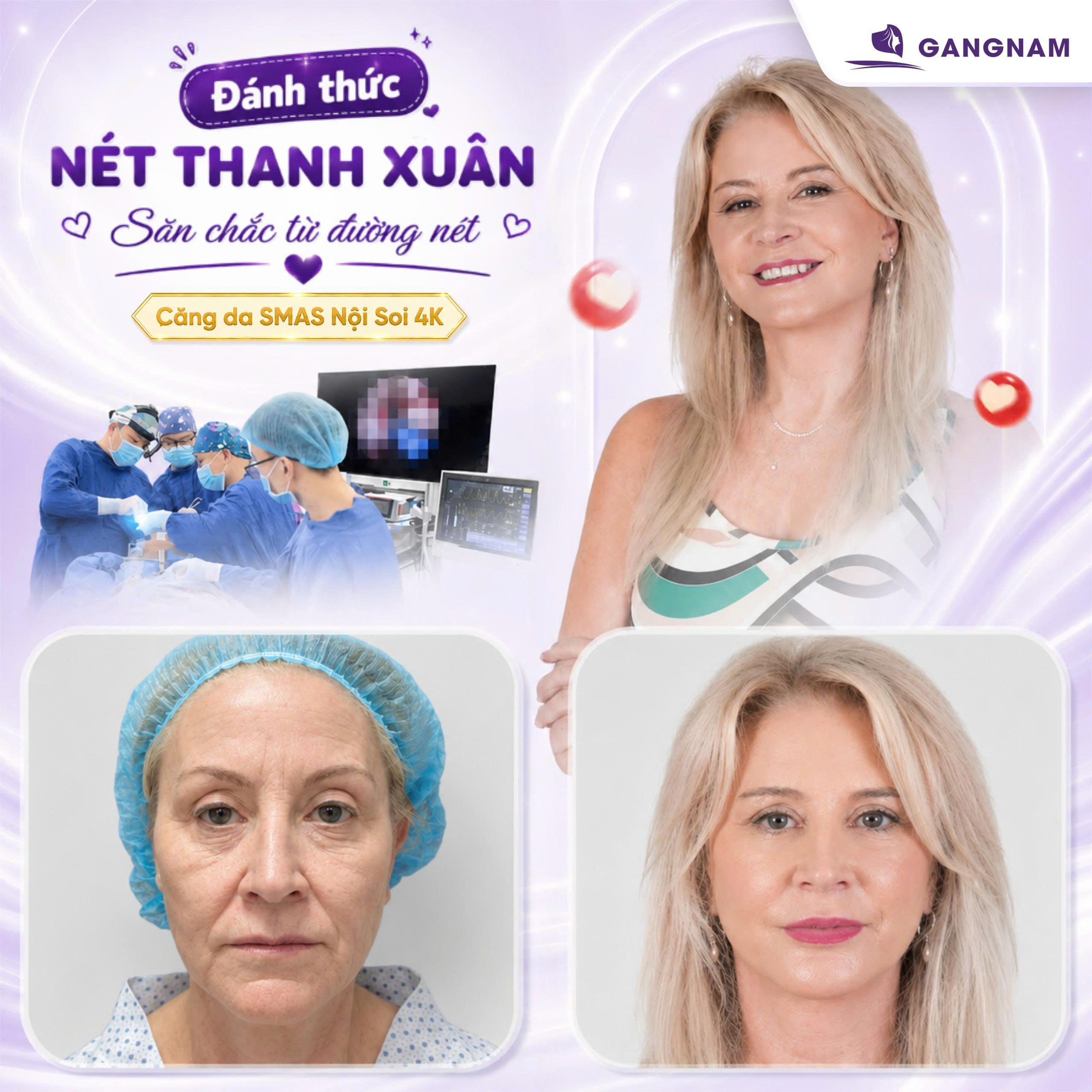 Nâng cơ mặt SMAS nội soi 4K – Giải pháp trẻ hóa toàn diện và tự nhiên 6 Nâng cơ mặt SMAS nội soi 4K tại Thẩm mỹ Gangnam