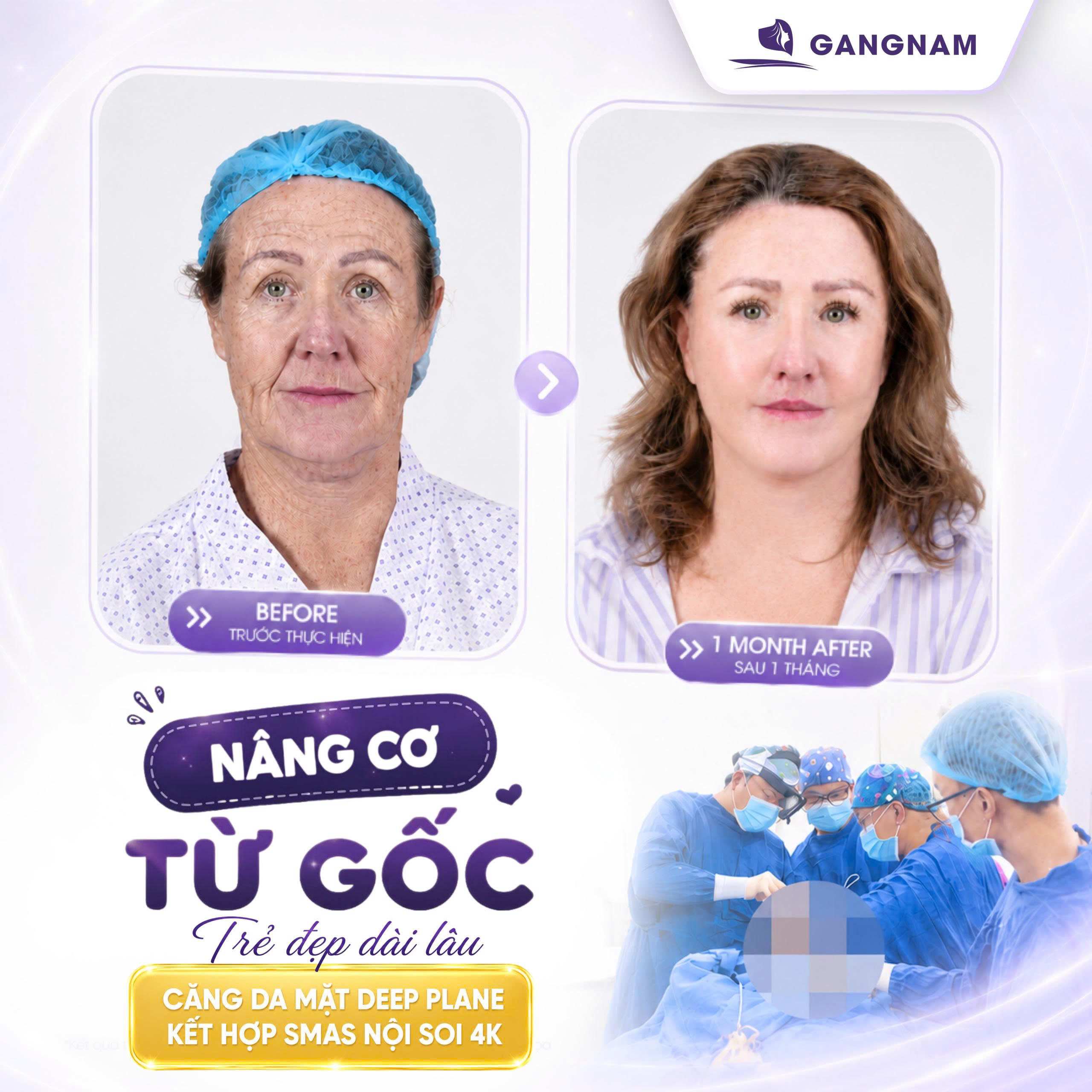 Căng da mặt bằng nội soi 4K – Giải pháp trẻ hóa hiện đại, tự nhiên và bền vững 6 Căng da mặt nội soi 4K tại Thẩm mỹ Gangnam – Giải pháp trẻ hóa chuyên sâu