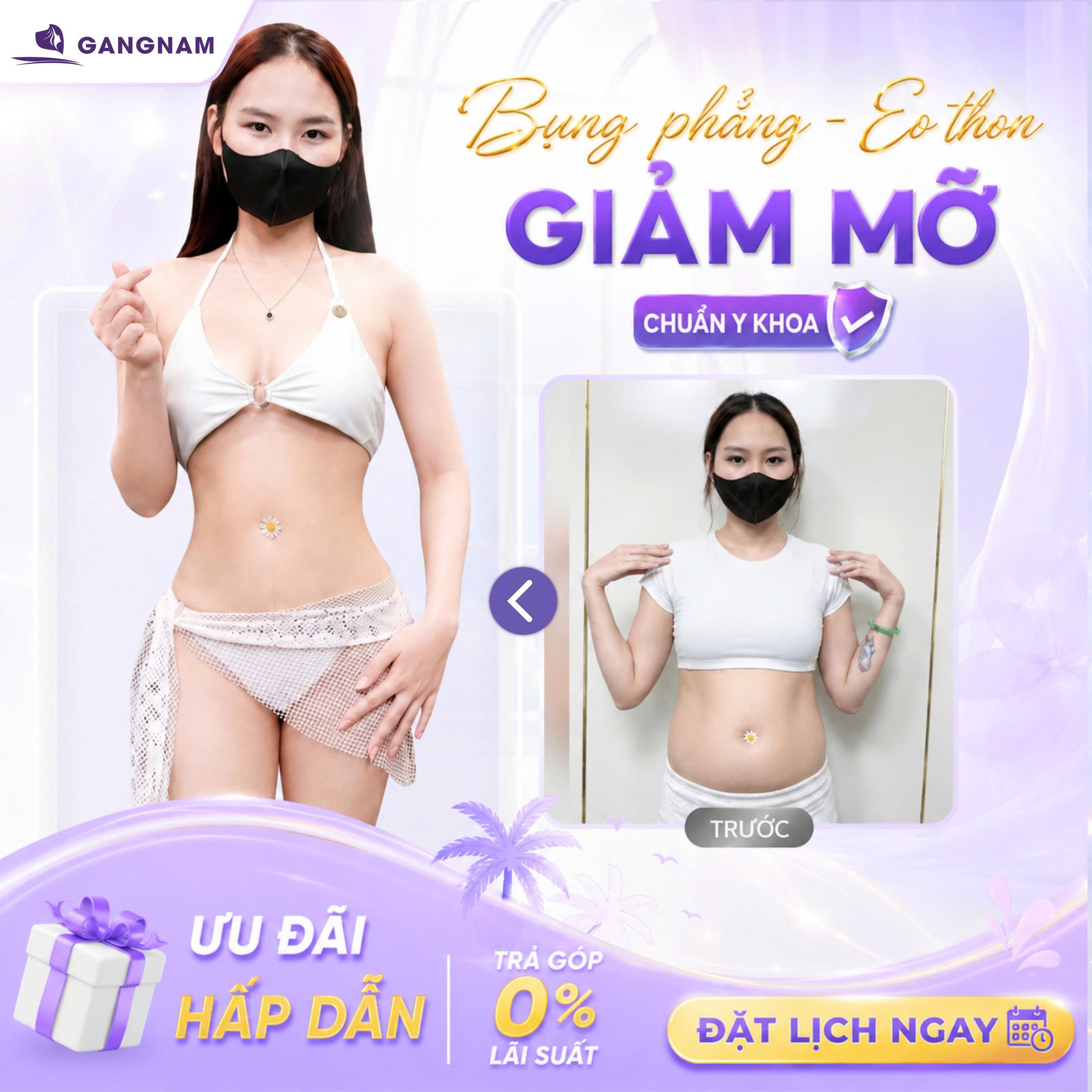 Hút mỡ hông nội soi 4k – Giải pháp tạo dáng eo thon tự nhiên và an toàn 4 Vì sao hút mỡ hông nội soi 4k được ưa chuộng hiện nay