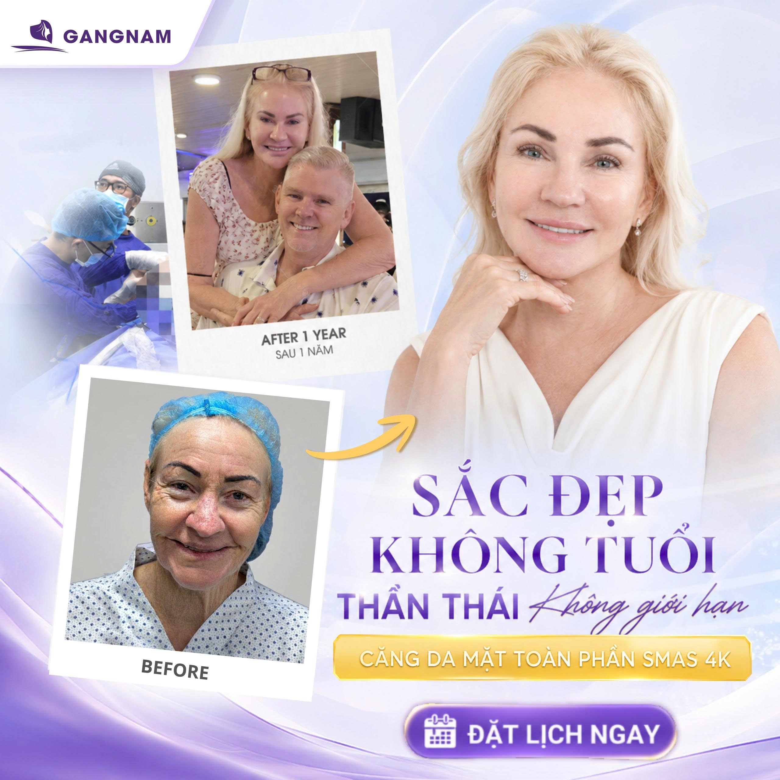 Trẻ hóa SMAS nội soi 4K: Giải pháp trẻ hóa da mặt vượt trội hiện nay 5 Trẻ hóa SMAS nội soi 4K: Giải pháp trẻ hóa da mặt vượt trội hiện nay 2