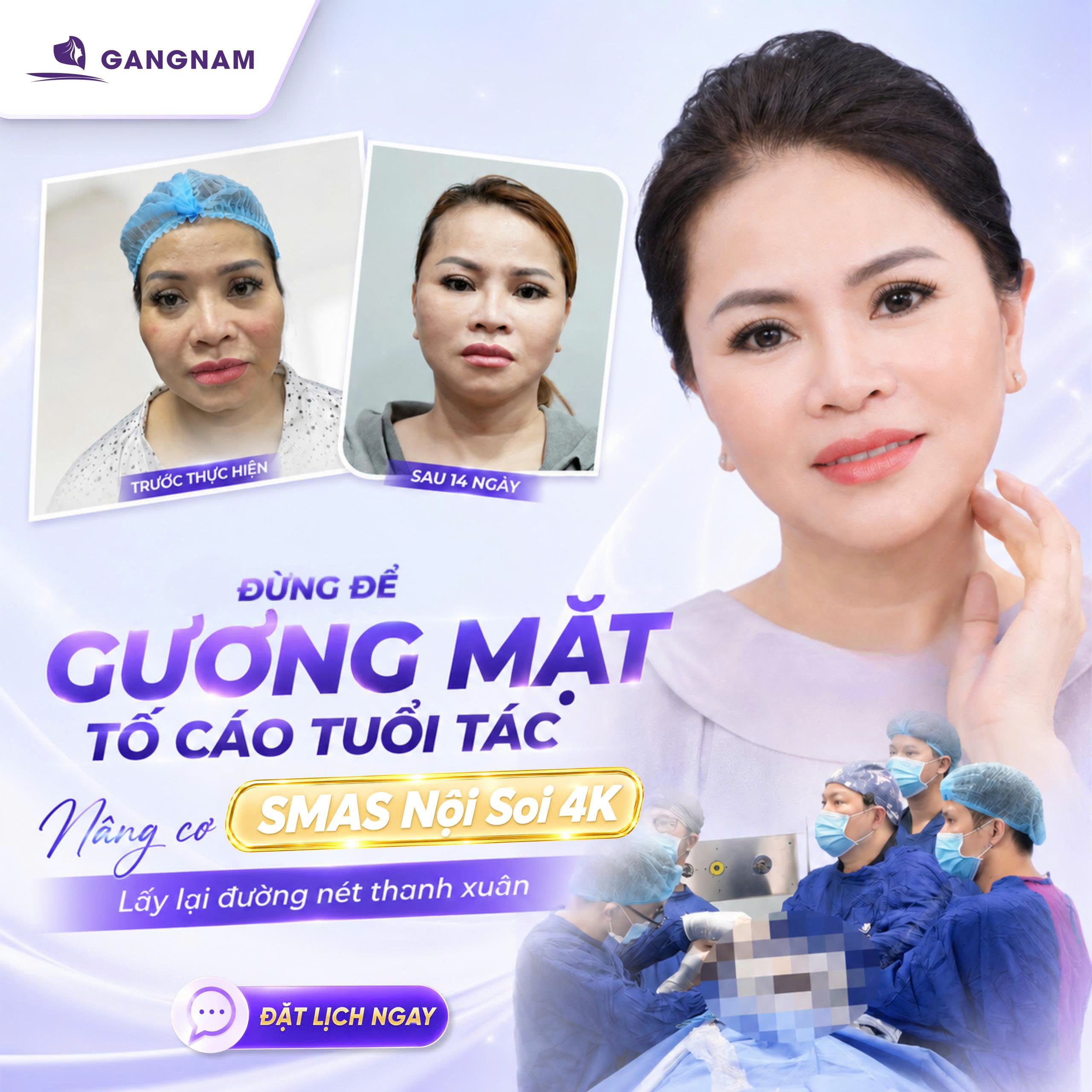 Trẻ hóa SMAS nội soi 4K: Giải pháp trẻ hóa da mặt vượt trội hiện nay 4 Công nghệ Trẻ hóa SMAS nội soi 4K là gì?