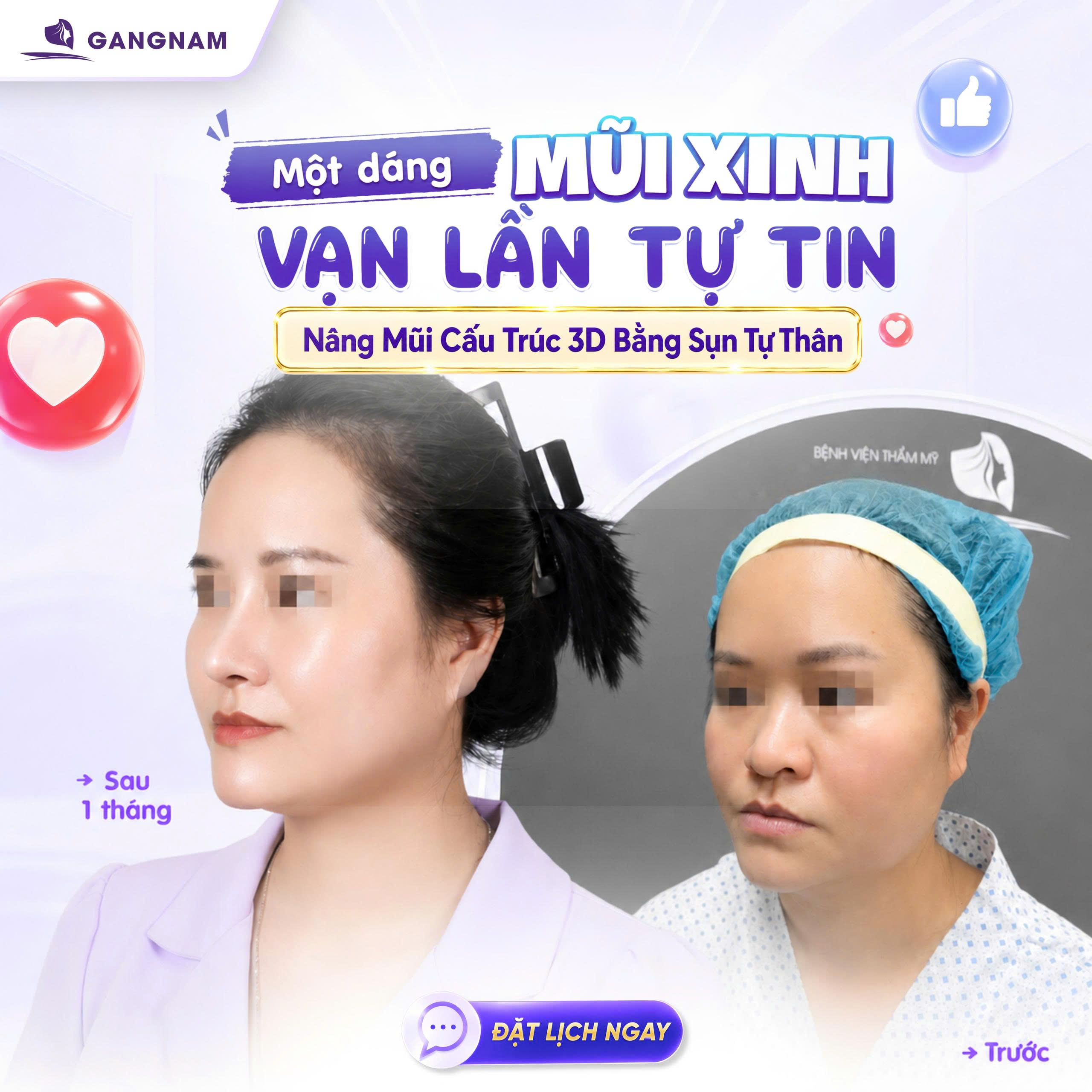 Thẩm mỹ nâng mũi cấu trúc – Giải pháp hoàn hảo cho dáng mũi đẹp tự nhiên và bền vững 6 Thẩm mỹ nâng mũi cấu trúc tại Thẩm mỹ Gangnam