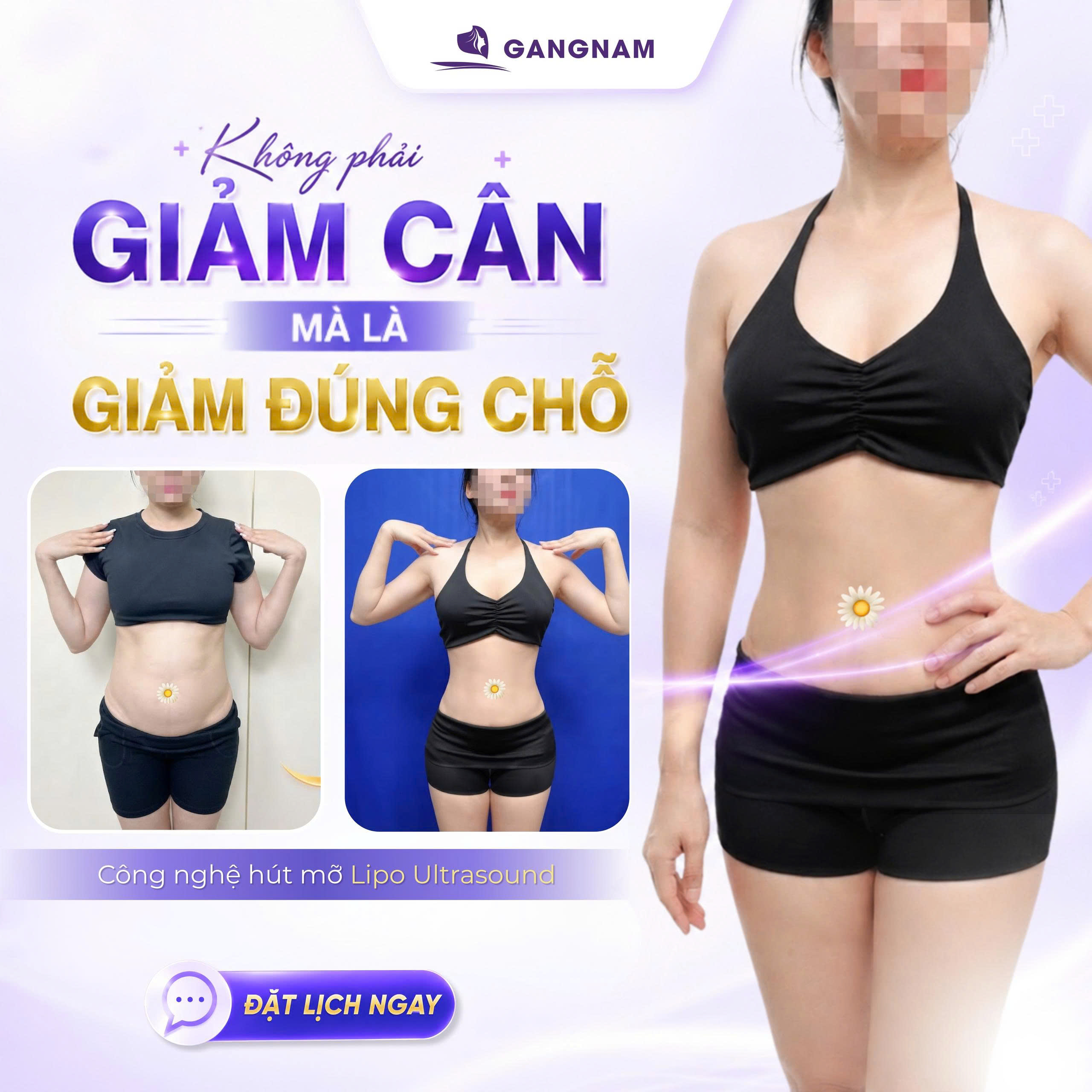 Hút mỡ vòng eo Lipo Ultrasound chuẩn y khoa: Giải pháp định hình vóc dáng hiện đại 4 Cơ chế hoạt động của Hút mỡ vòng eo Lipo Ultrasound chuẩn y khoa
