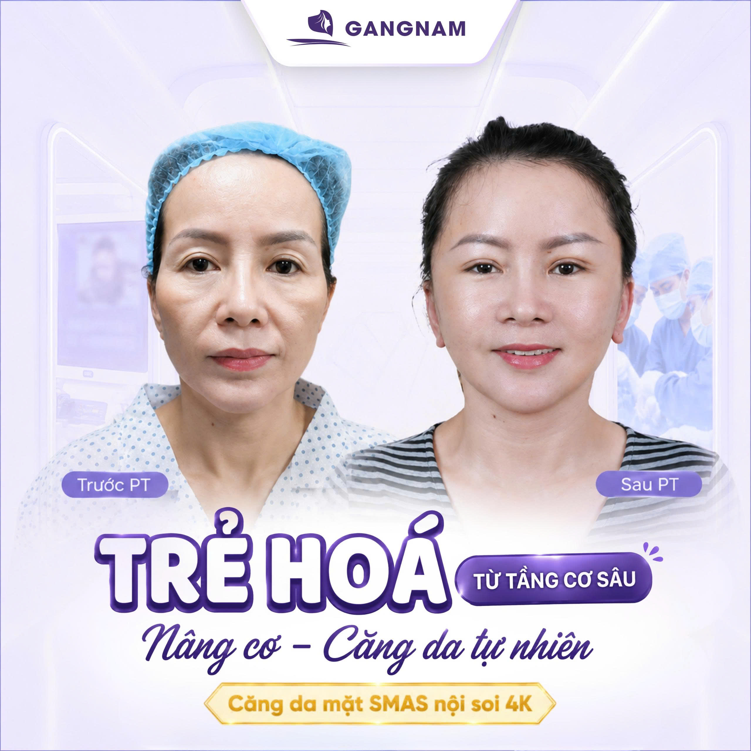 Căng Da Mặt Ở Đâu Uy Tín? Địa Chỉ Trẻ Hóa Được Nhiều Người Quan Tâm 5 Căng Da Mặt Ở Đâu Uy Tín? Địa Chỉ Trẻ Hóa Được Nhiều Người Quan Tâm 2