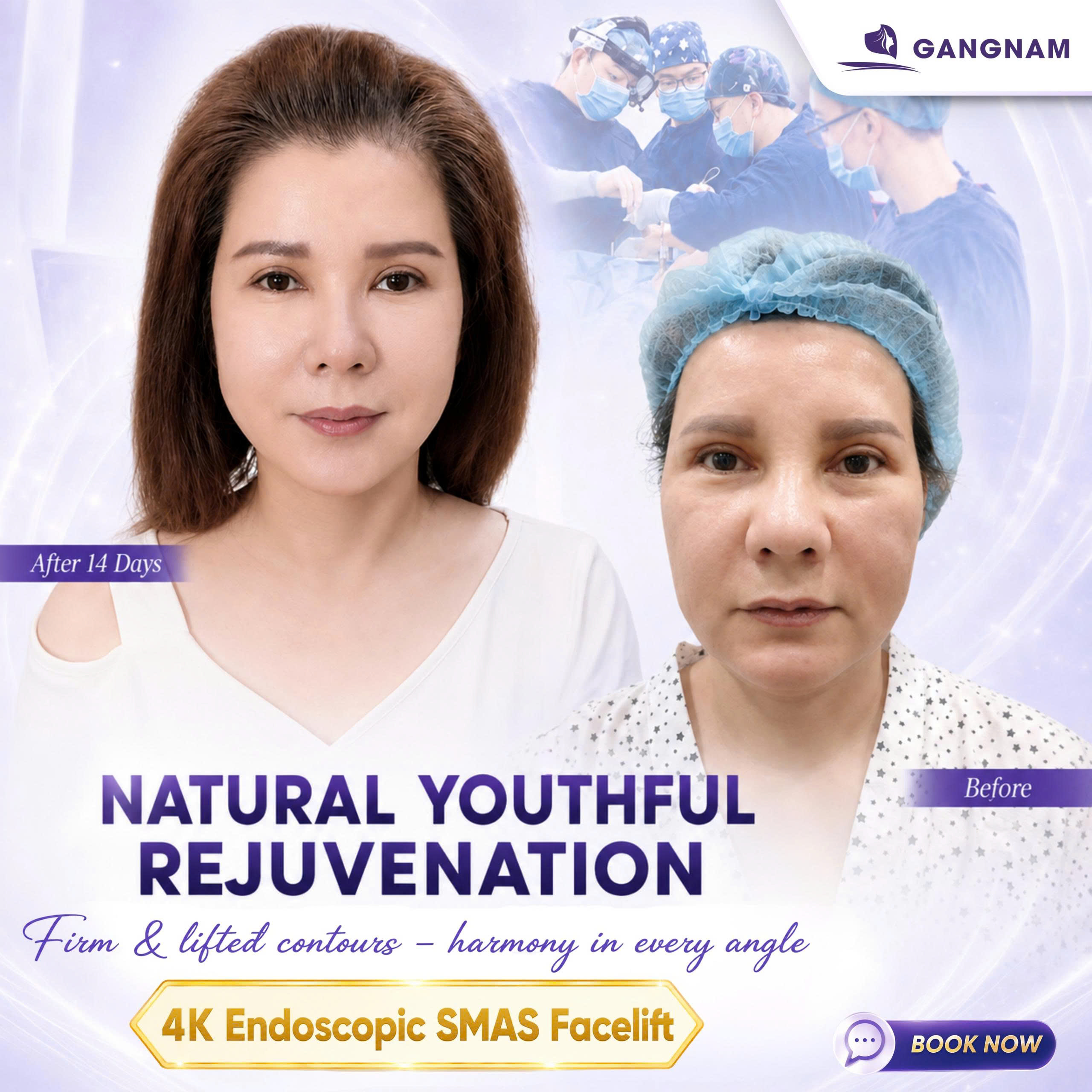 Phẫu thuật trẻ hóa mặt nội soi 4K – Giải pháp hiện đại giúp khuôn mặt săn chắc tự nhiên 6 THẨM MỸ GANGNAM – TRẺ HÓA GƯƠNG MẶT TOÀN DIỆN VỚI NỘI SOI 4K