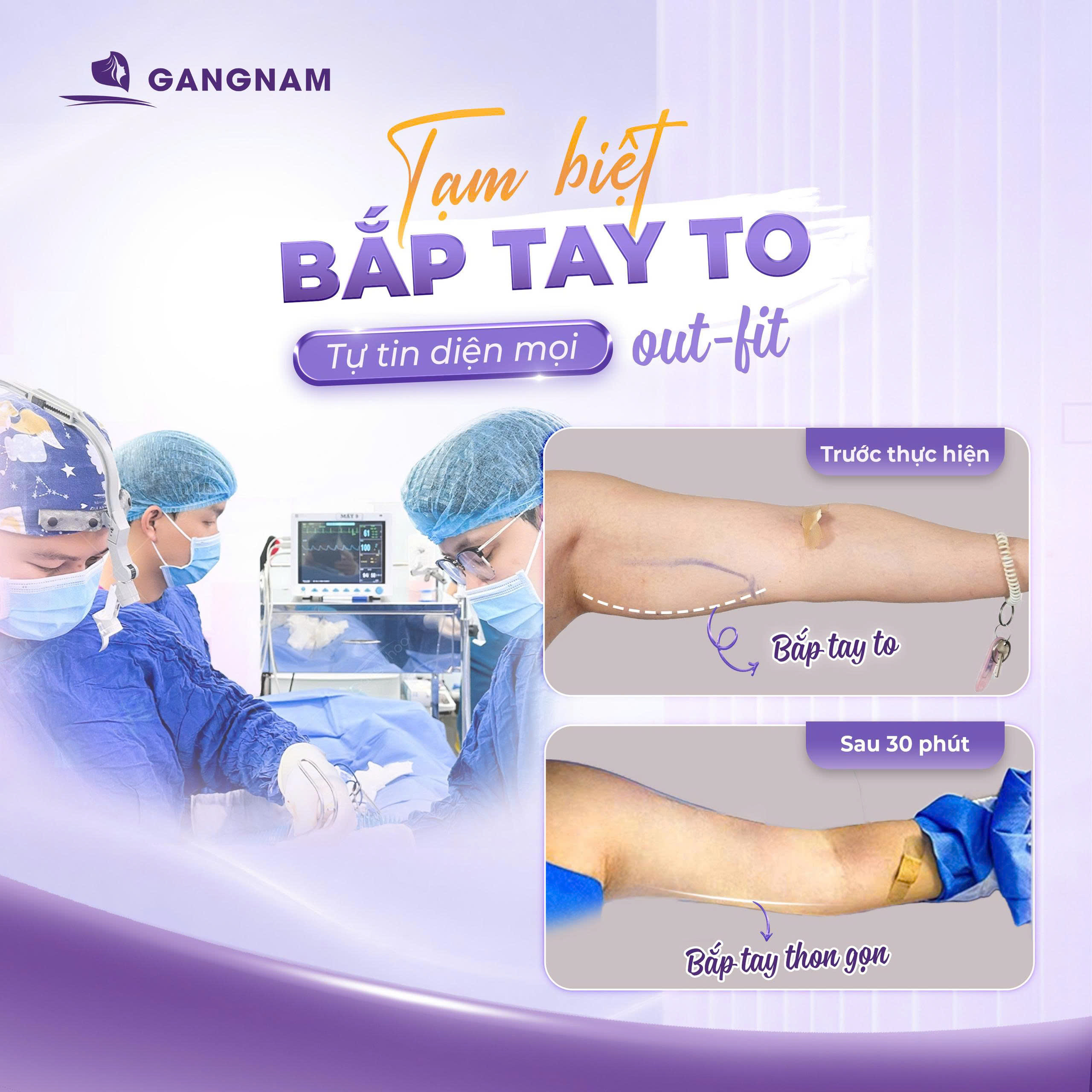 Hút mỡ bắp tay Lipo hiện đại – Giải pháp thon gọn cánh tay an toàn và hiệu quả 6 Hút mỡ bắp tay Lipo tại Thẩm mỹ Gangnam