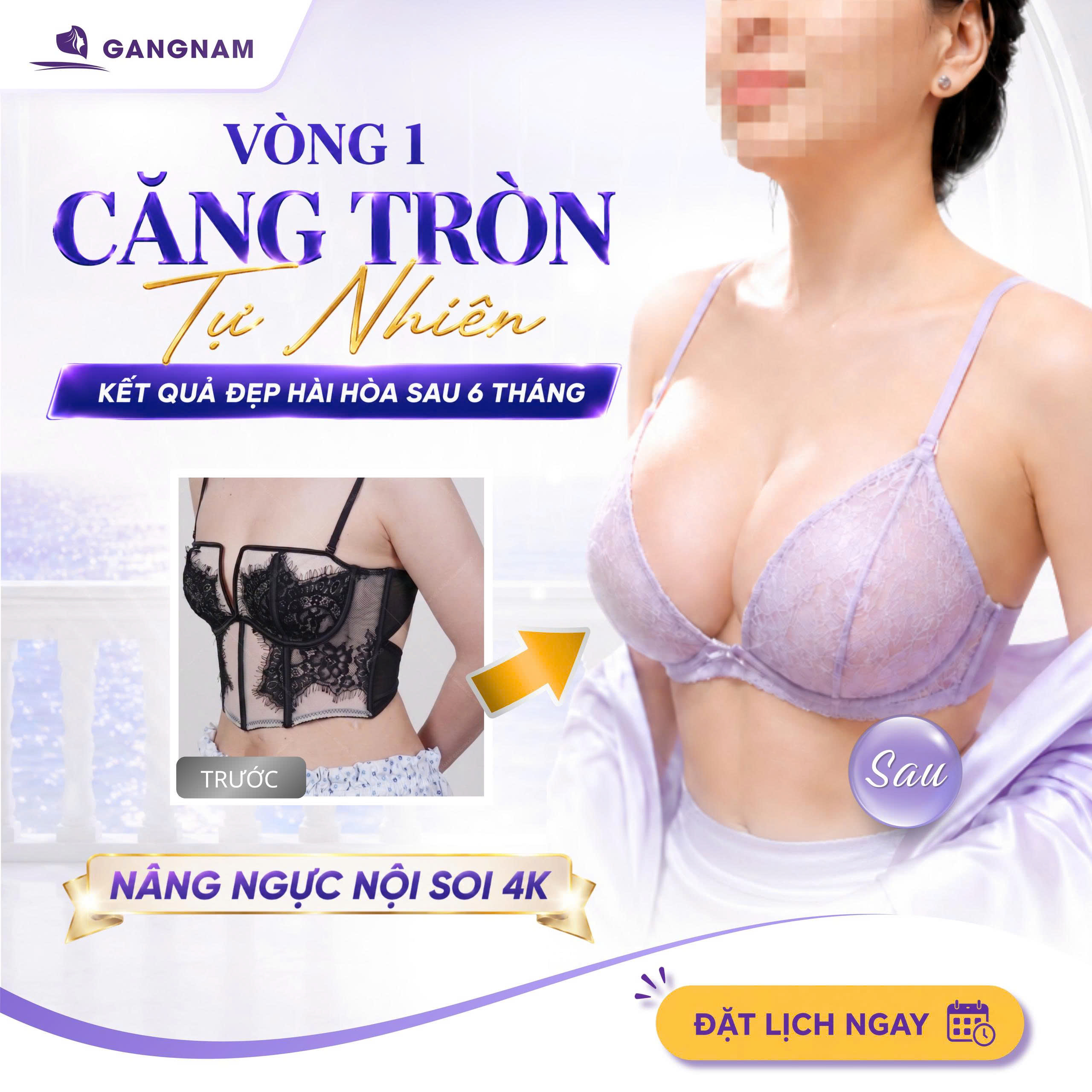 Nâng ngực túi gel silicon cao cấp – Lựa chọn an toàn và tự nhiên cho vòng một 4 Tổng quan về nâng ngực túi gel silicon cao cấp