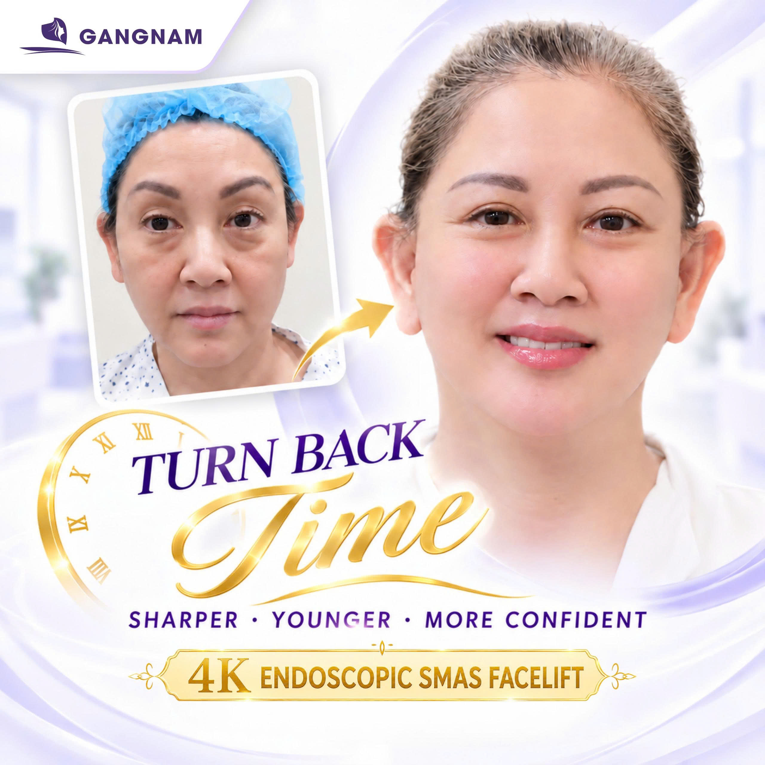 Công nghệ nội soi 4K trẻ hóa da mặt – Giải pháp can thiệp tối thiểu hiệu quả cao 6 Công nghệ nội soi 4K trẻ hóa da mặt tại Thẩm mỹ Gangnam
