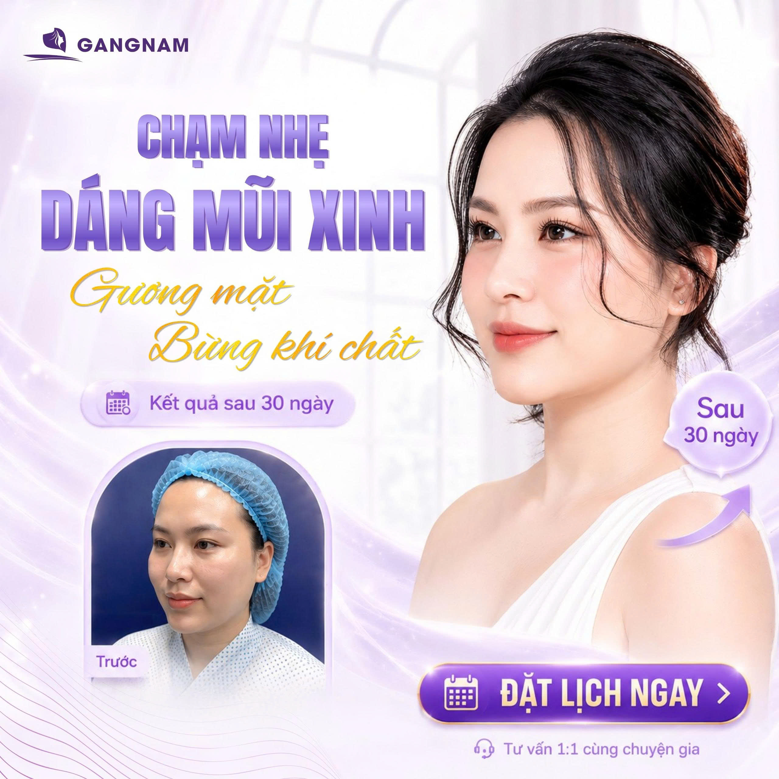 Nâng mũi 3D S-Line tự nhiên: Giải pháp kiến tạo dáng mũi thanh tú chuẩn tỷ lệ vàng 6 Thẩm mỹ Gangnam – Địa chỉ nâng mũi 3D S-Line tự nhiên được nhiều khách hàng lựa chọn