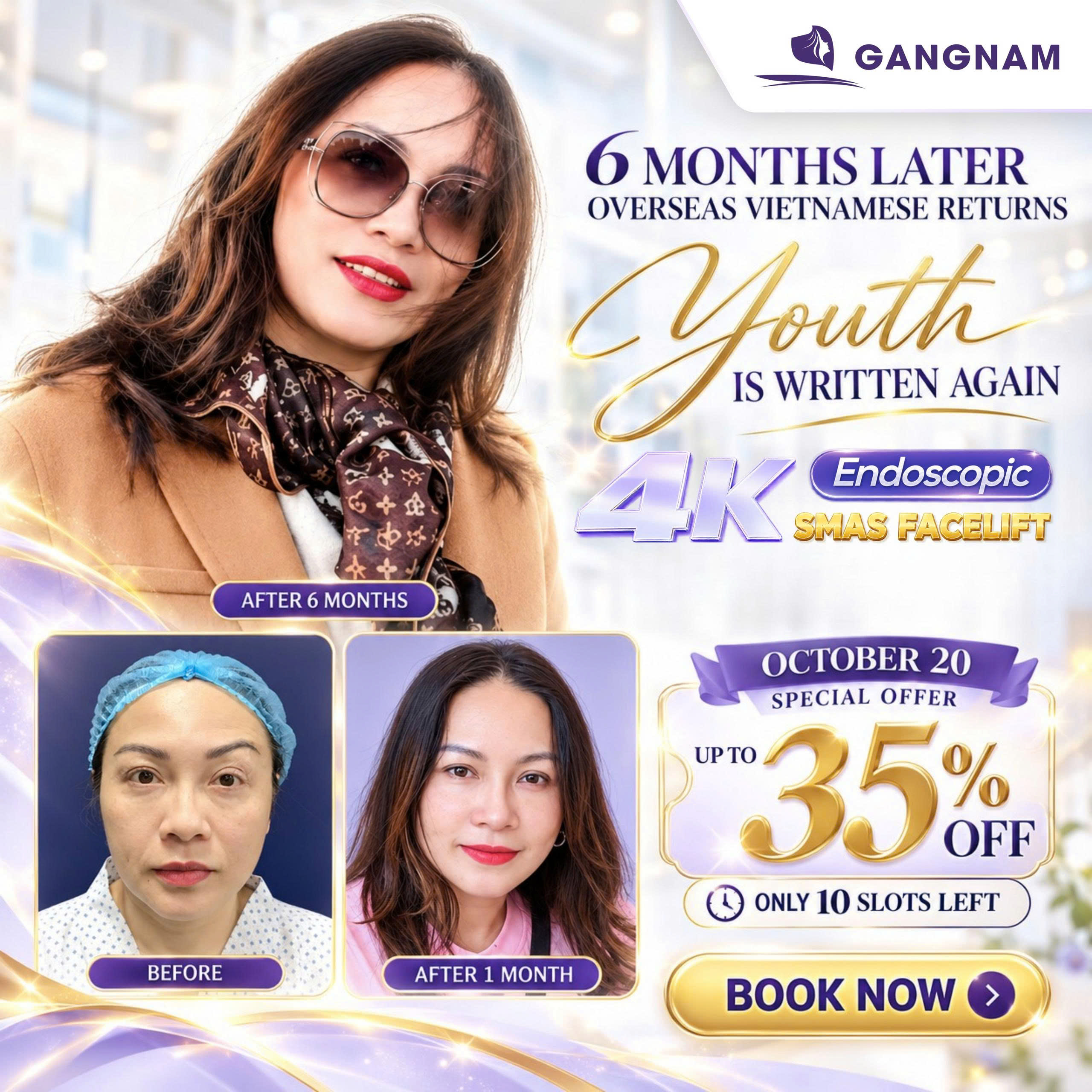 Công nghệ trẻ hóa nội soi 4K – Giải pháp trẻ hóa da hiện đại và an toàn 6 Trẻ hóa nội soi 4K tại Bệnh viện Thẩm mỹ Gangnam – Nâng cơ trẻ trung, giữ trọn nét riêng