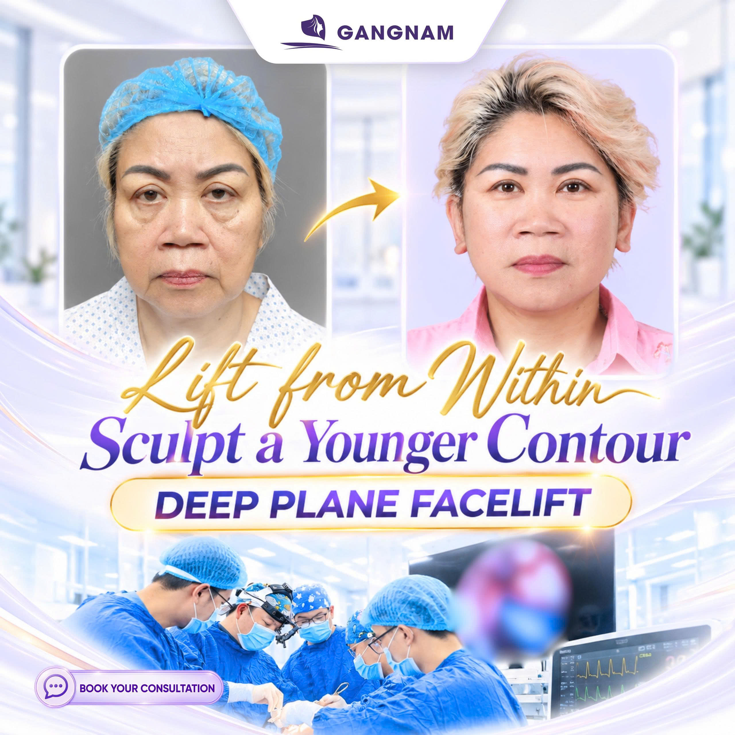Căng da mặt nội soi cho da chảy xệ – Giải pháp trẻ hóa và nâng đỡ khuôn mặt 6 Thẩm mỹ Gangnam – Địa chỉ tư vấn trẻ hóa khuôn mặt