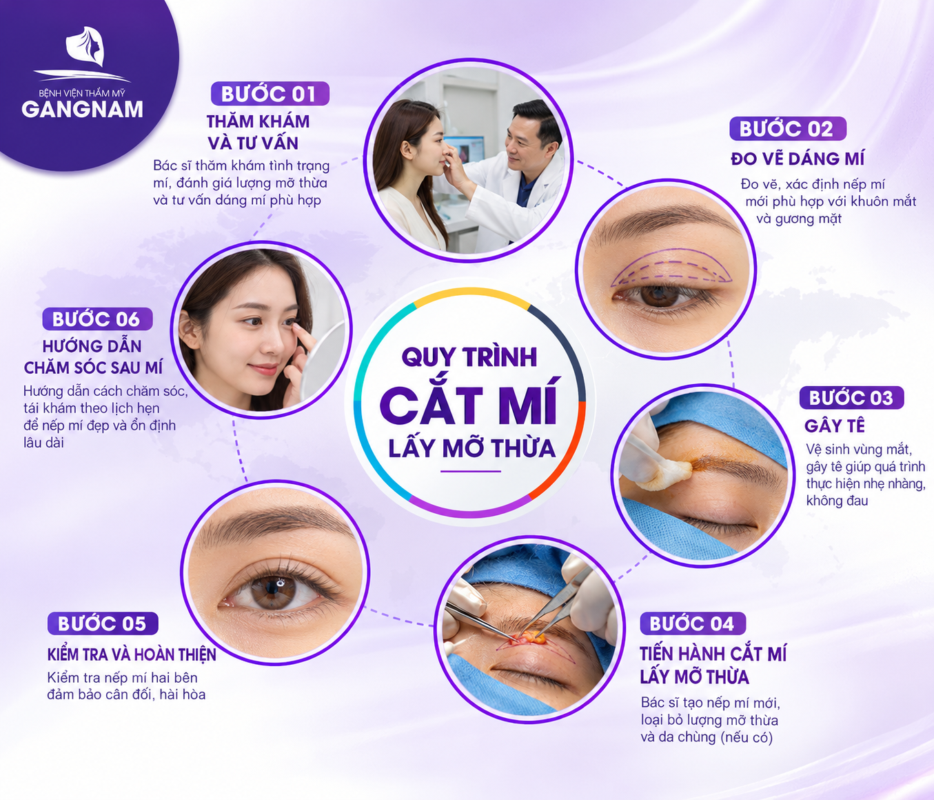 Cắt mí Eyelid lấy mỡ thừa: Giải pháp tạo mắt hai mí tự nhiên 5 Cắt mí Eyelid lấy mỡ thừa: Giải pháp tạo mắt hai mí tự nhiên 2