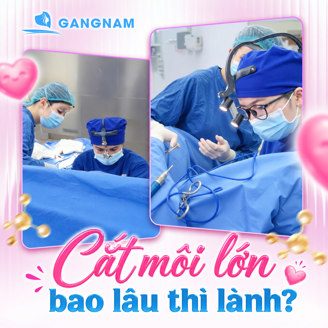 Cắt môi lớn bao lâu lành? Thời gian hồi phục và cách chăm sóc đúng cách 4 Cắt môi lớn bao lâu lành theo từng giai đoạn?